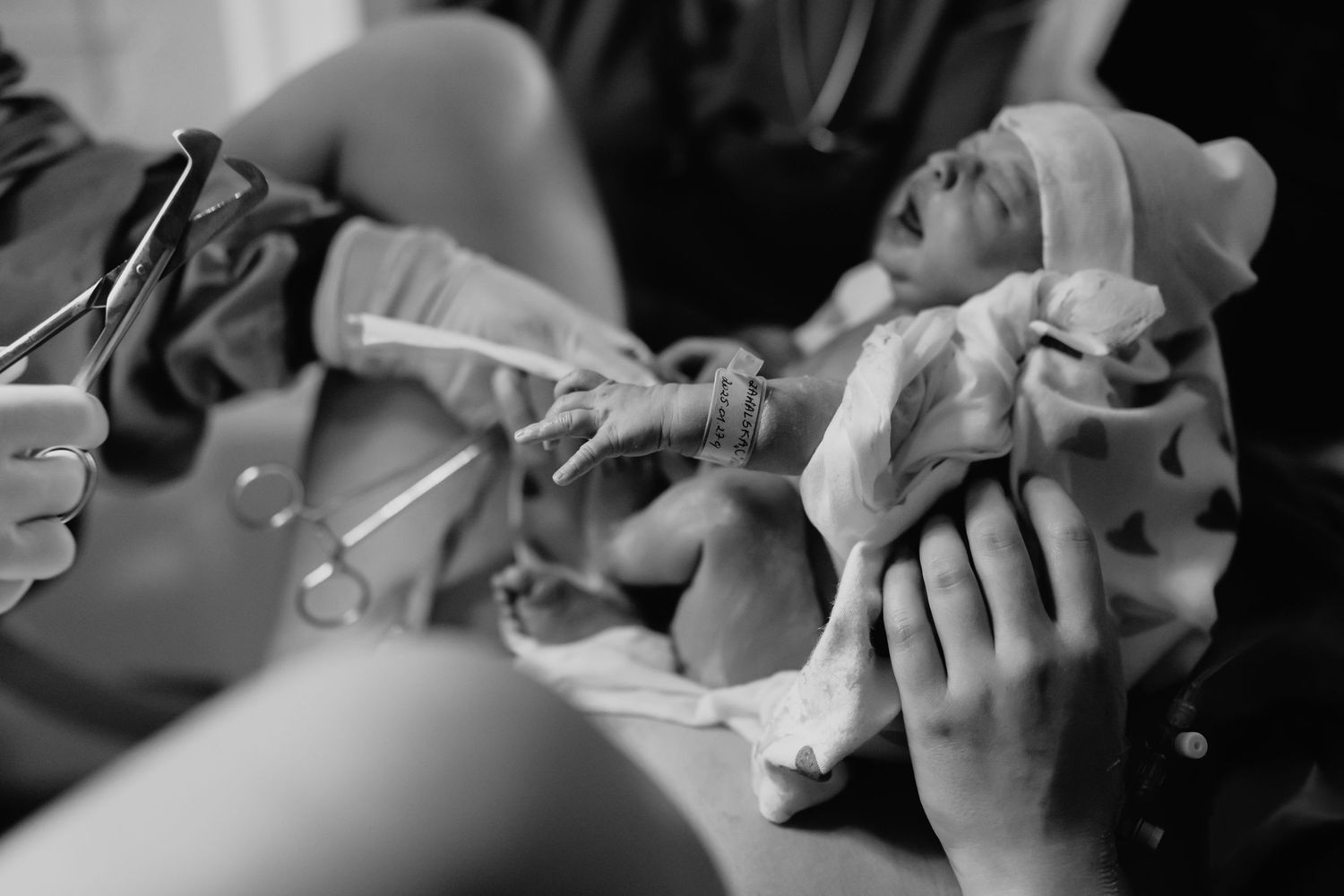 Black and white close-up of a newborn baby being held by medical staff moments after birth.reportaż porodu Rybnik, Wodzisław Śląski