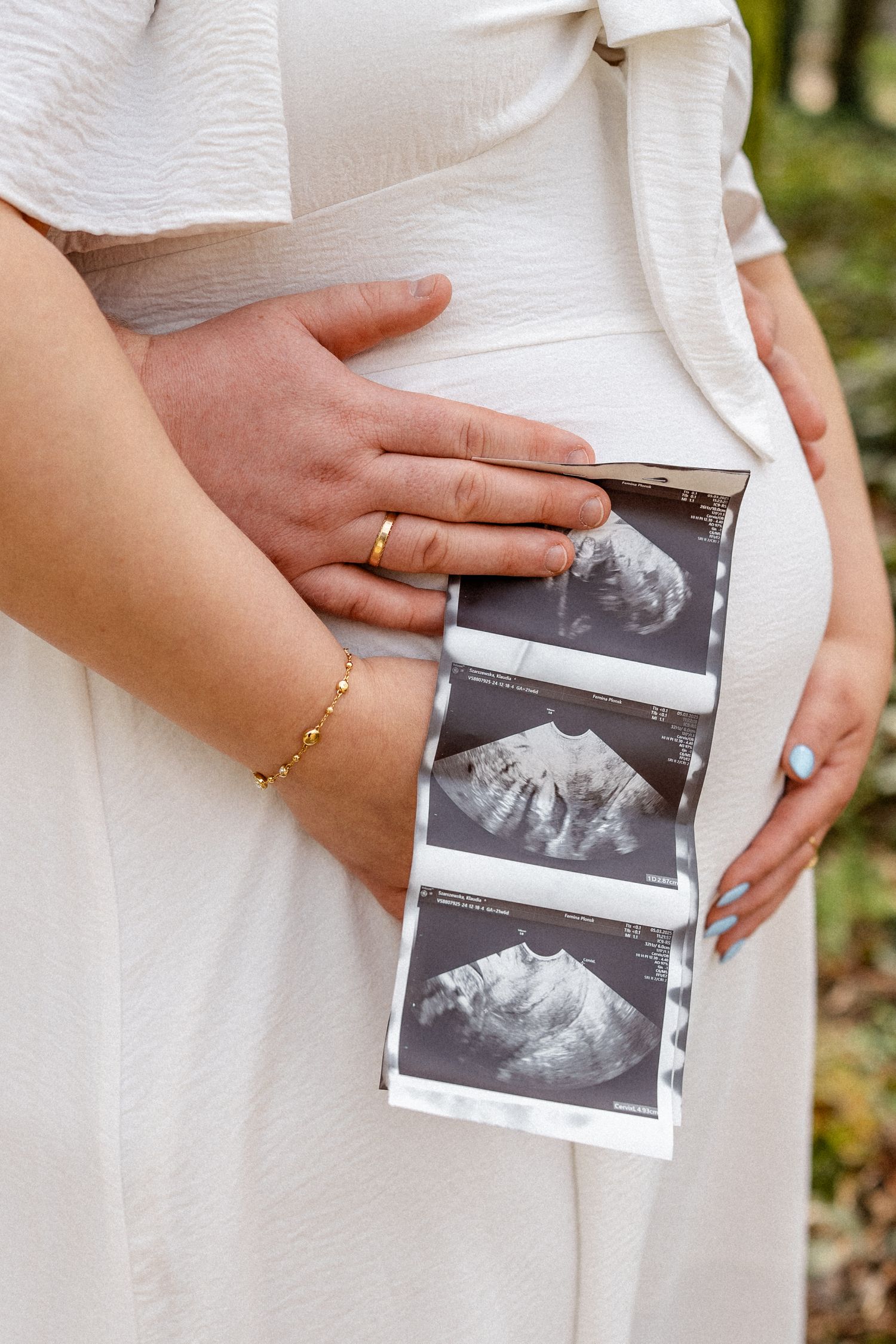 Hands holding ultrasound photos against a white maternity dress in natural lighting.