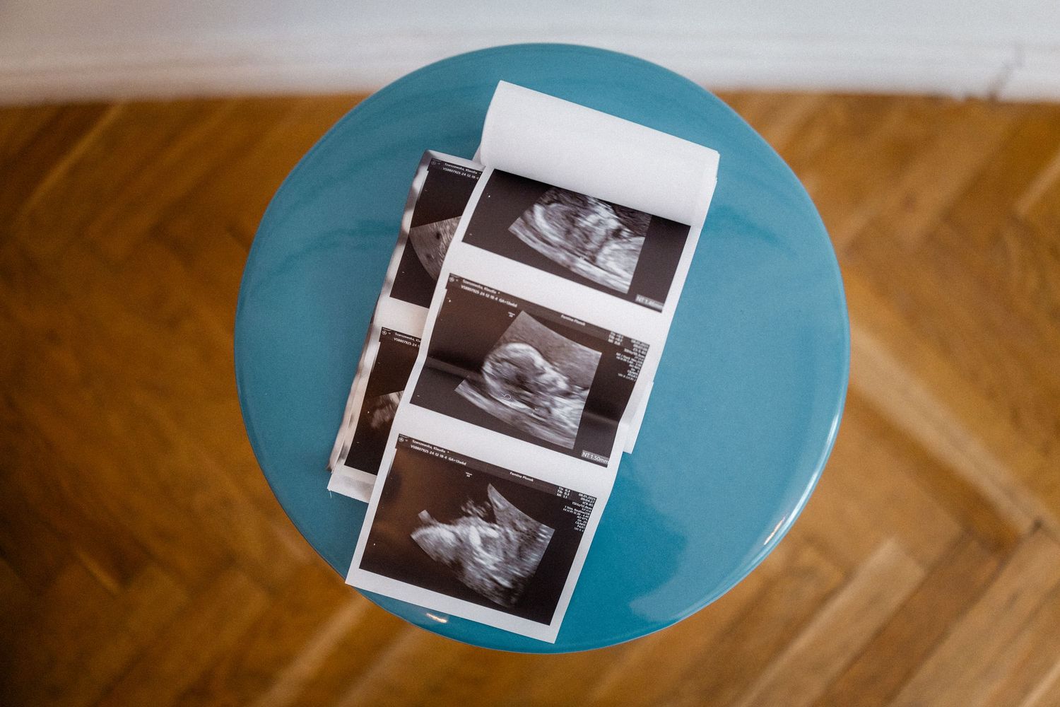 Ultrasound photos displayed on turquoise blue round table surface.