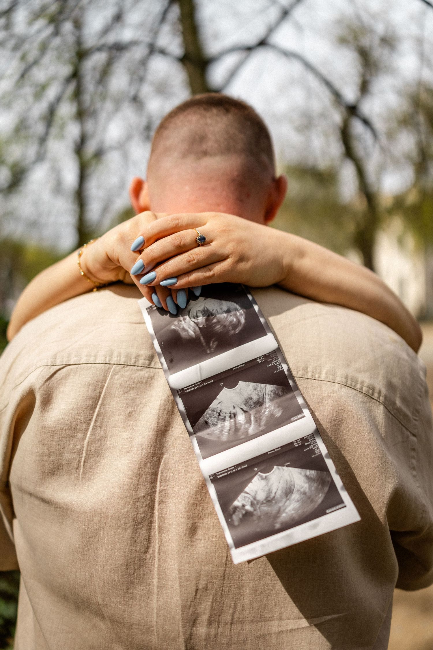 Ultrasound photos displayed against someone's back in an outdoor setting.