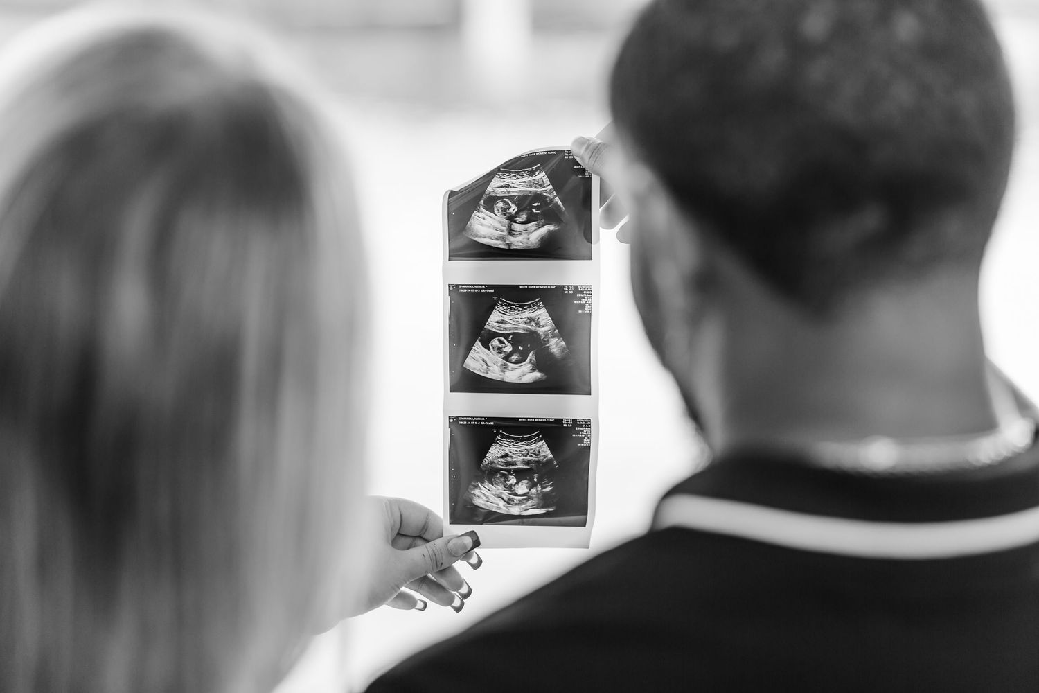 Black and white photo of couple looking at ultrasound images showing their developing baby during pregnancy.