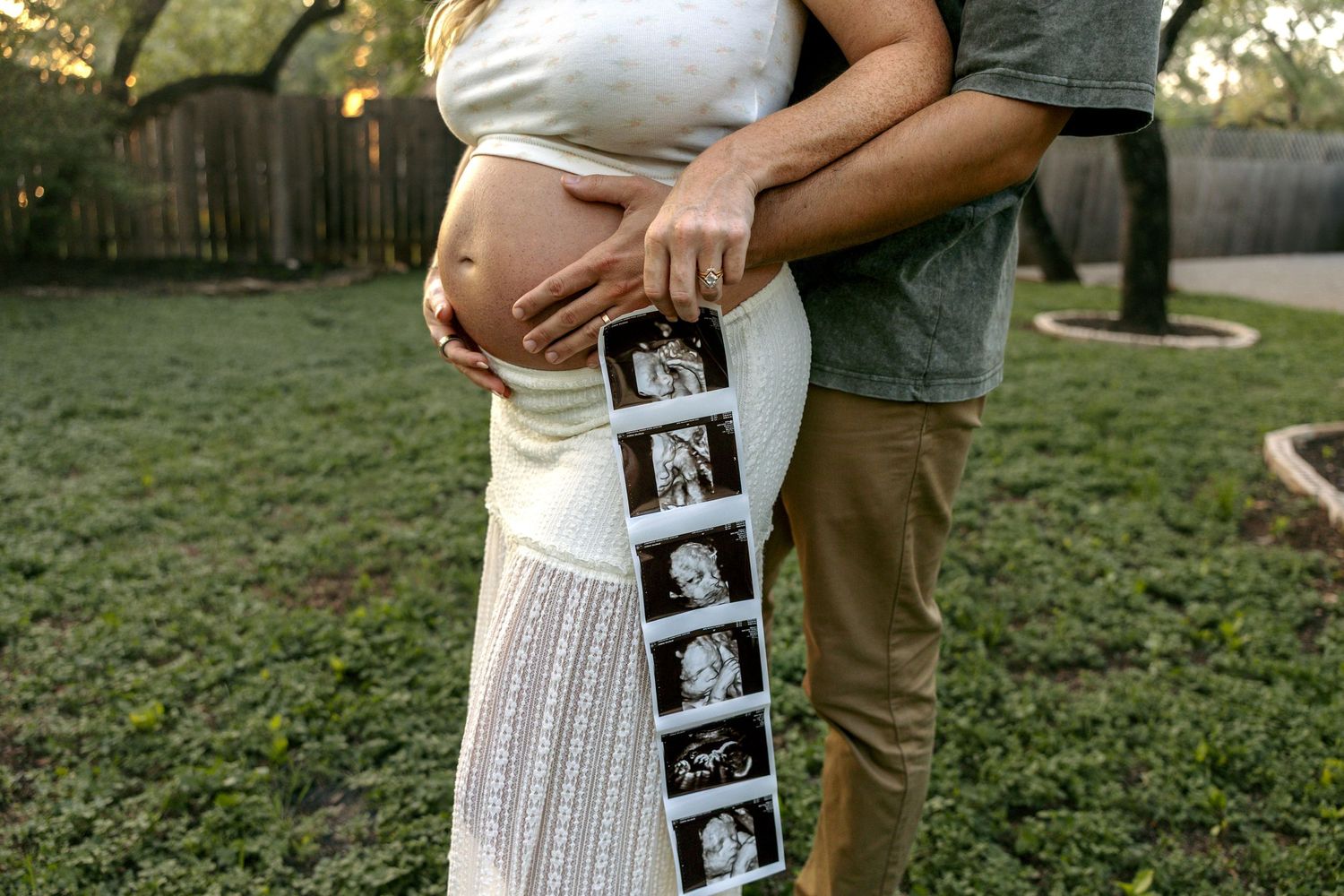 Expecting couple poses outdoors holding ultrasound photos while embracing in a backyard maternity photo session.