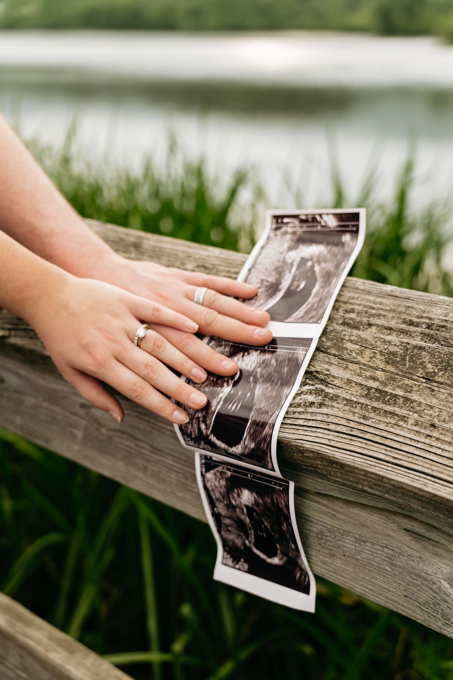 A hand places a sequence of sonogram photos on a weathered wooden railing outdoors with greenery in the background.