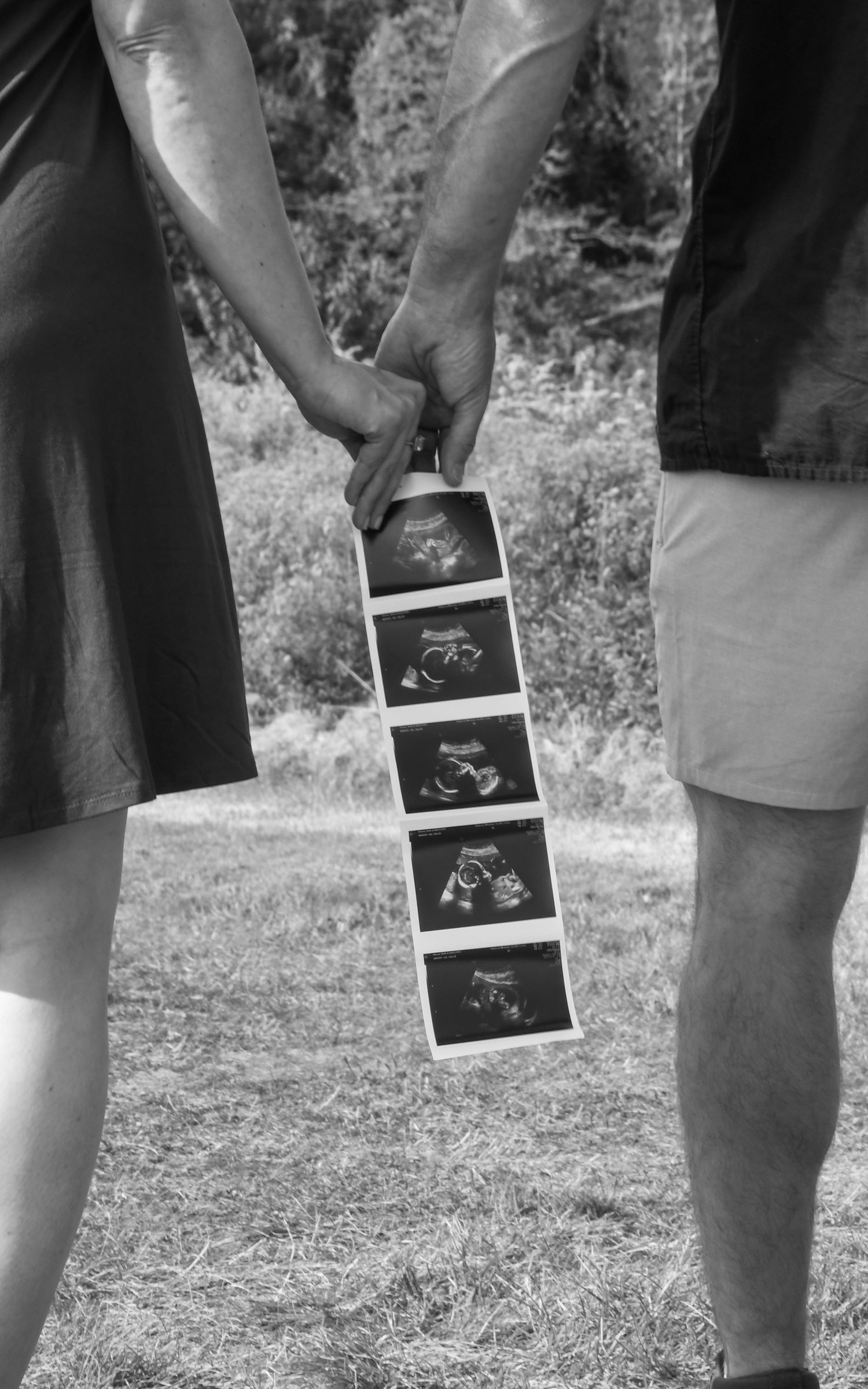 A couple holds a strip of ultrasound photos outdoors in black and white, showing their baby's development.