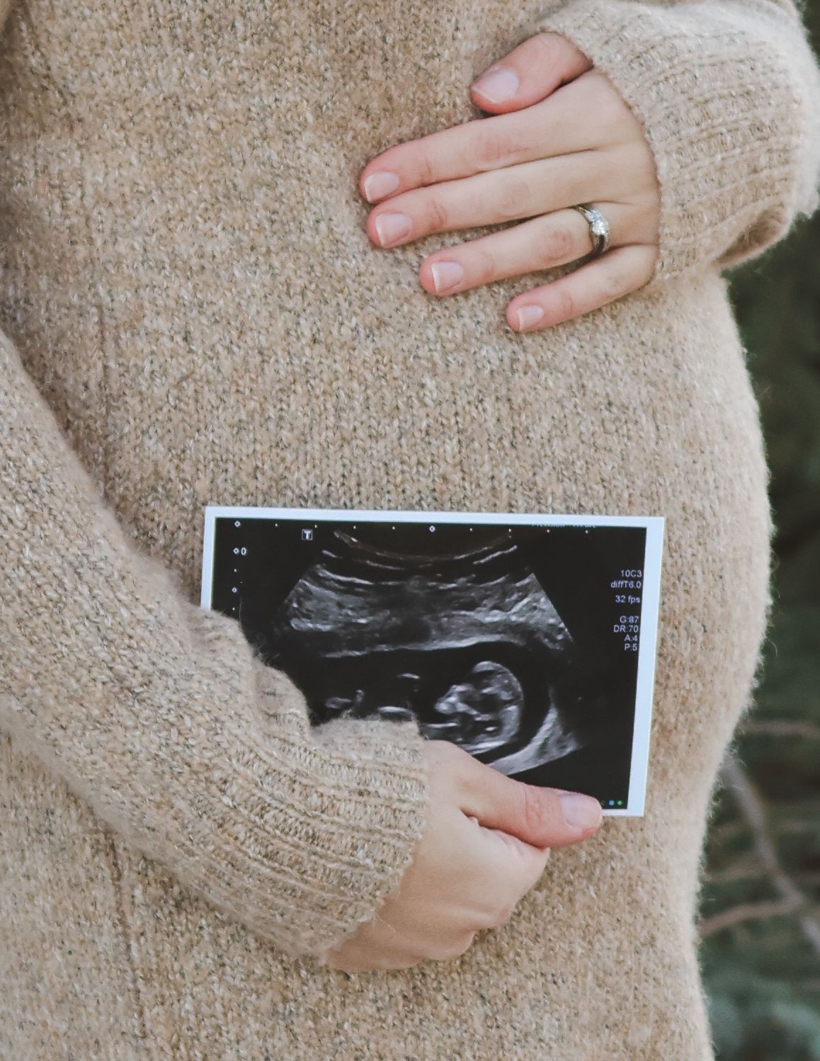 Close-up of pregnant woman in beige sweater holding ultrasound photo against baby bump outdoors.