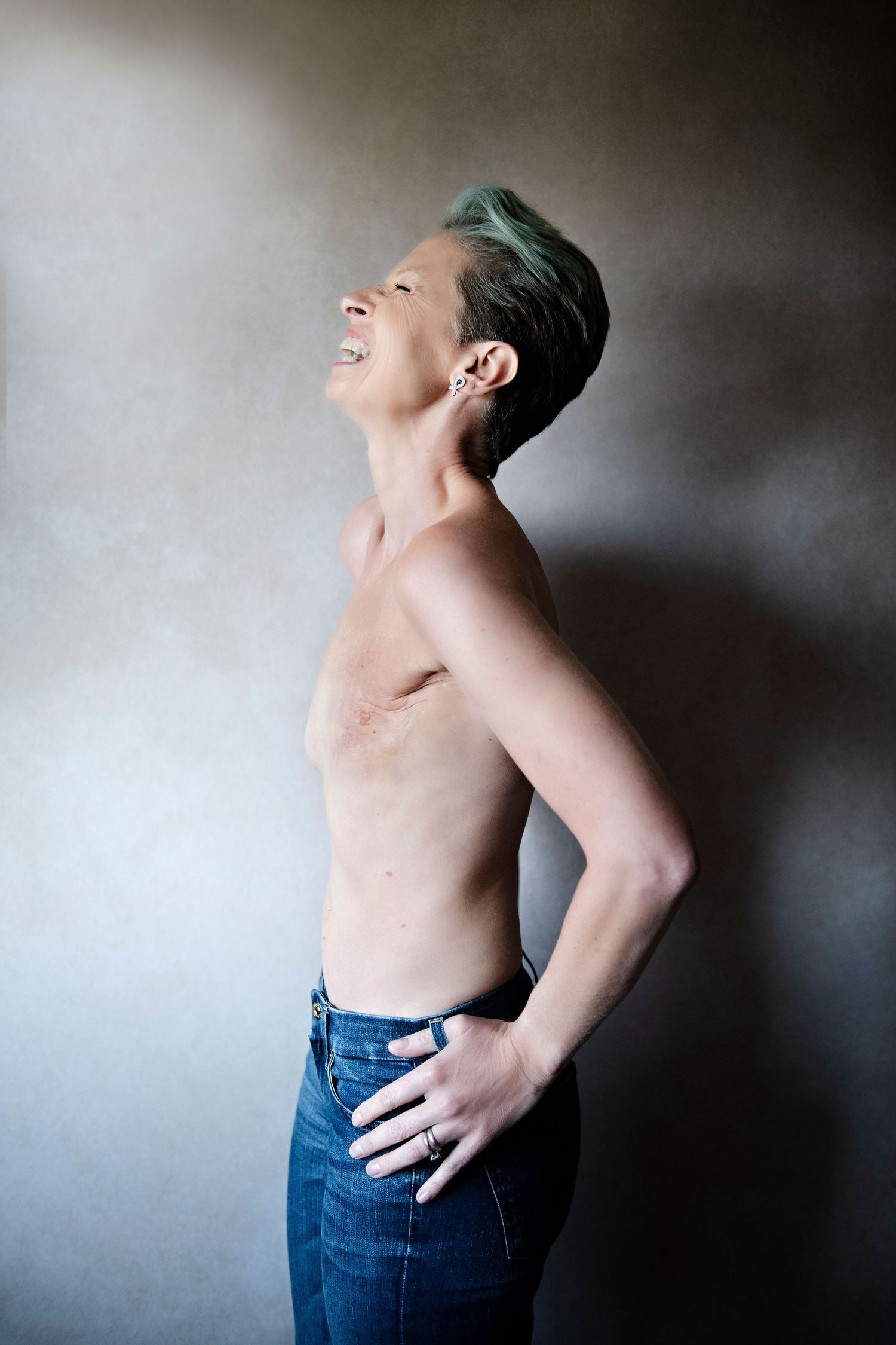 Person with green-tinted hair poses shirtless in profile, showing a scar, wearing blue jeans.