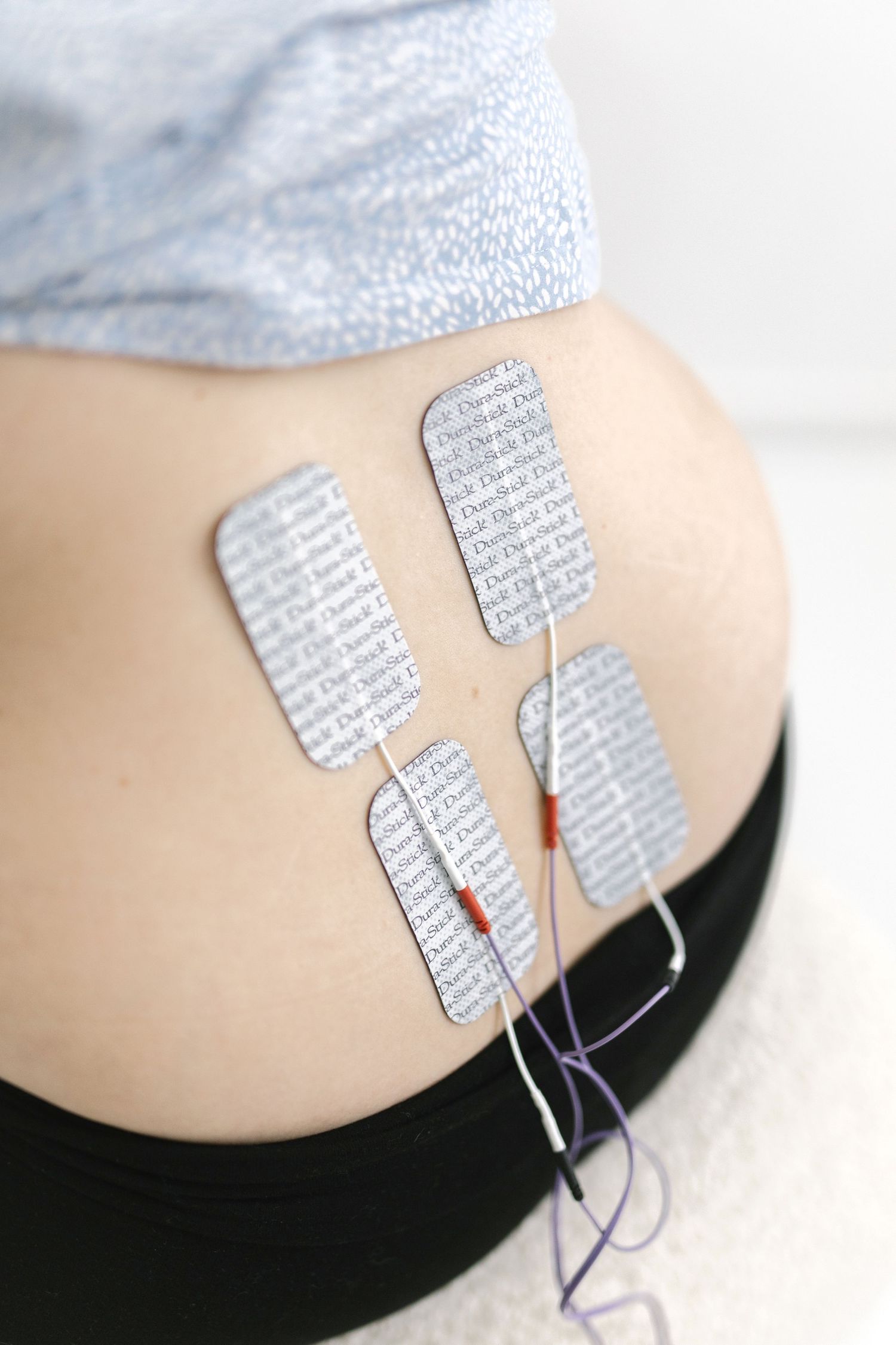 Medical electrodes attached to skin showing electrical monitoring setup.