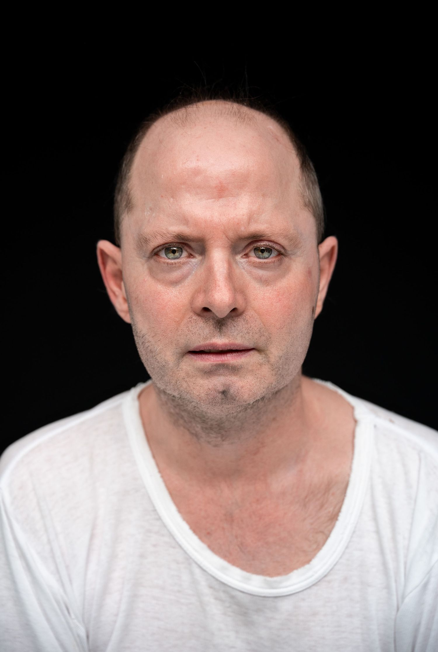 Bald middle-aged man with a serious expression wearing a white t-shirt against a black background.
