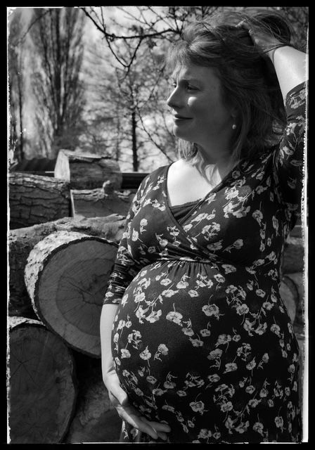 A series of black and white portraits showing someone in a floral dress reclining outdoors against a tree in natural lighting.