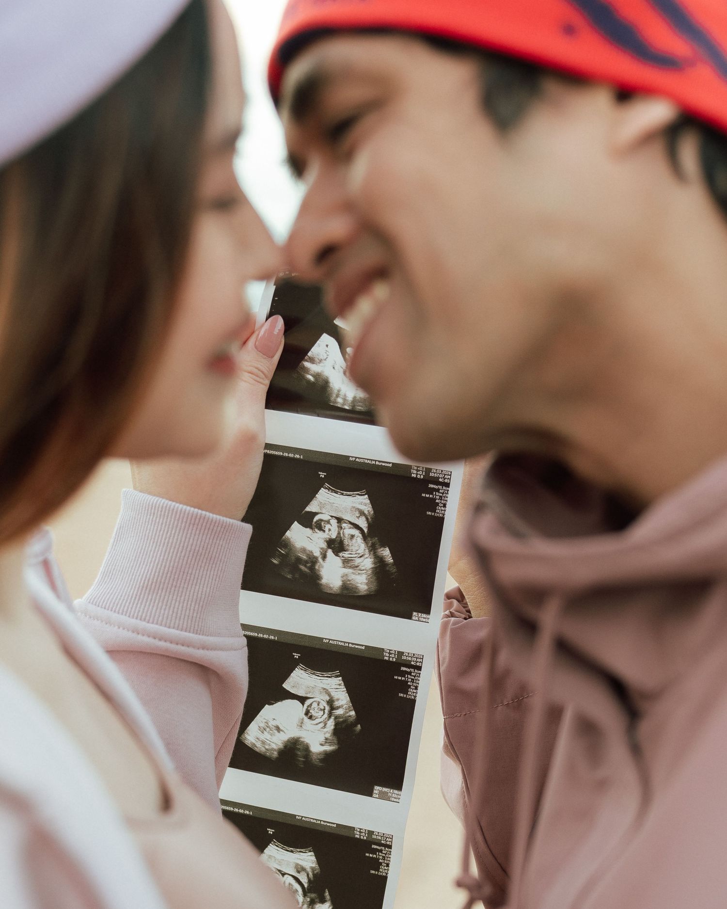 Smiling couple shares a tender moment holding ultrasound photos close together outdoors.