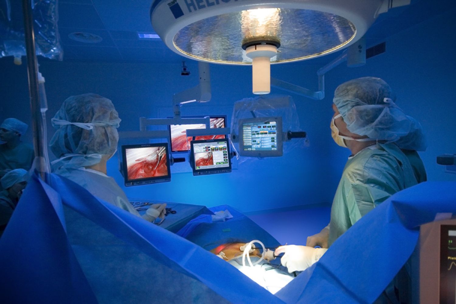 Operating theater during surgical procedure with monitors and equipment visible.