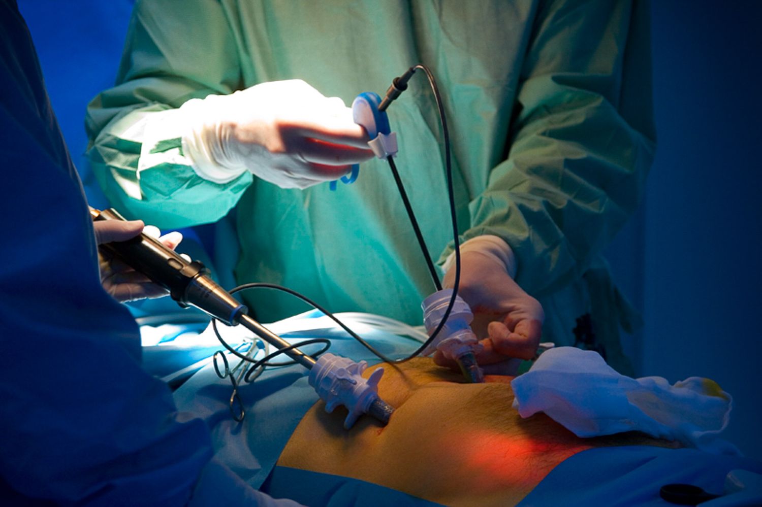Medical team performing surgery in operating room with blue lighting and surgical equipment.