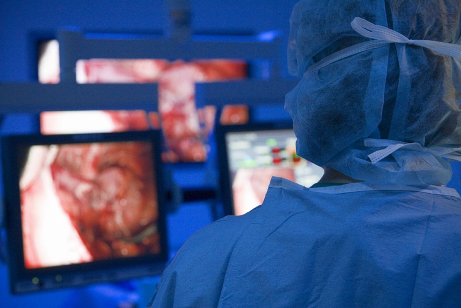 Surgical team performing operation with multiple monitoring screens in blue-lit environment.