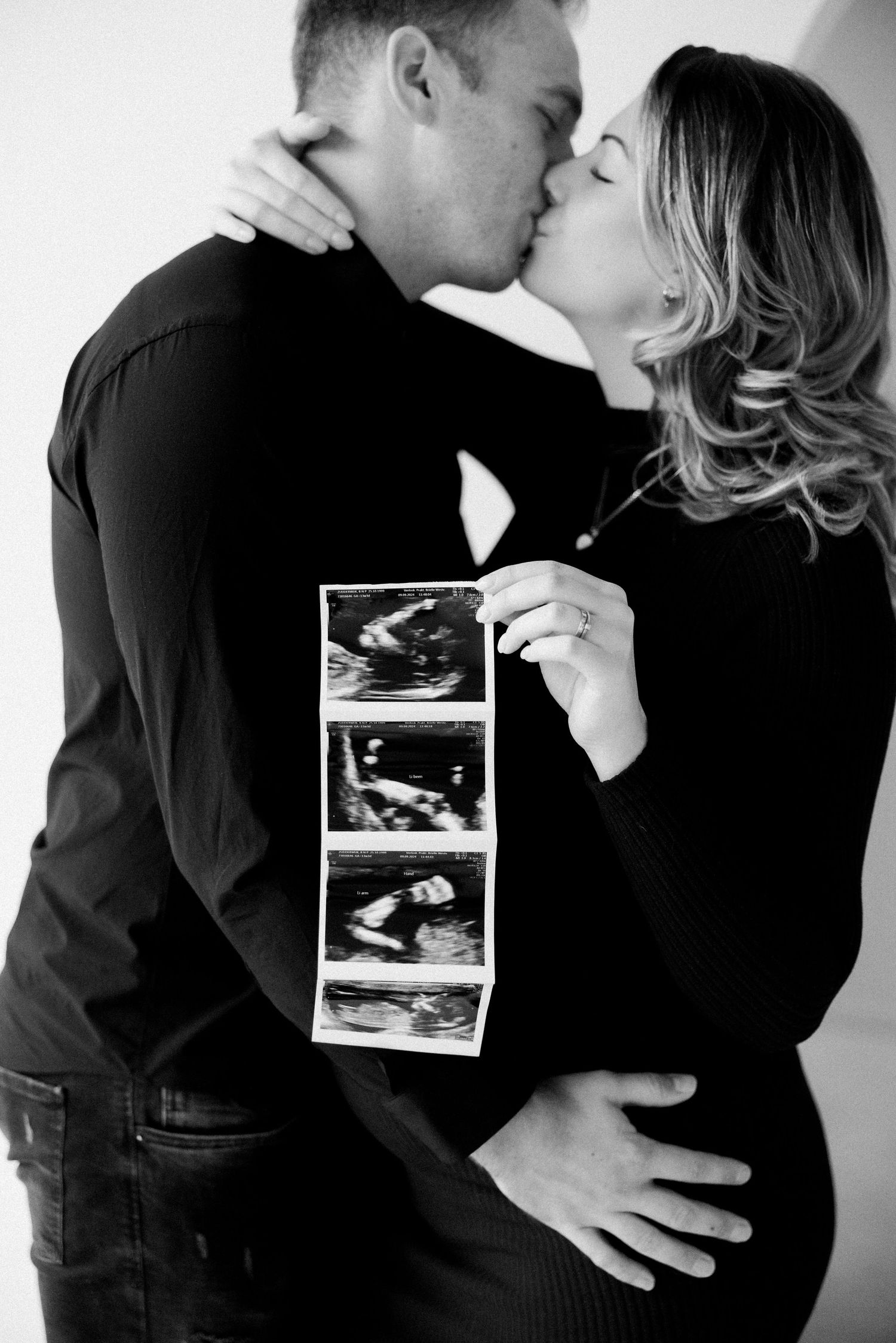 Black and white photo series showing couple kissing while holding ultrasound photos in progressive sequence.