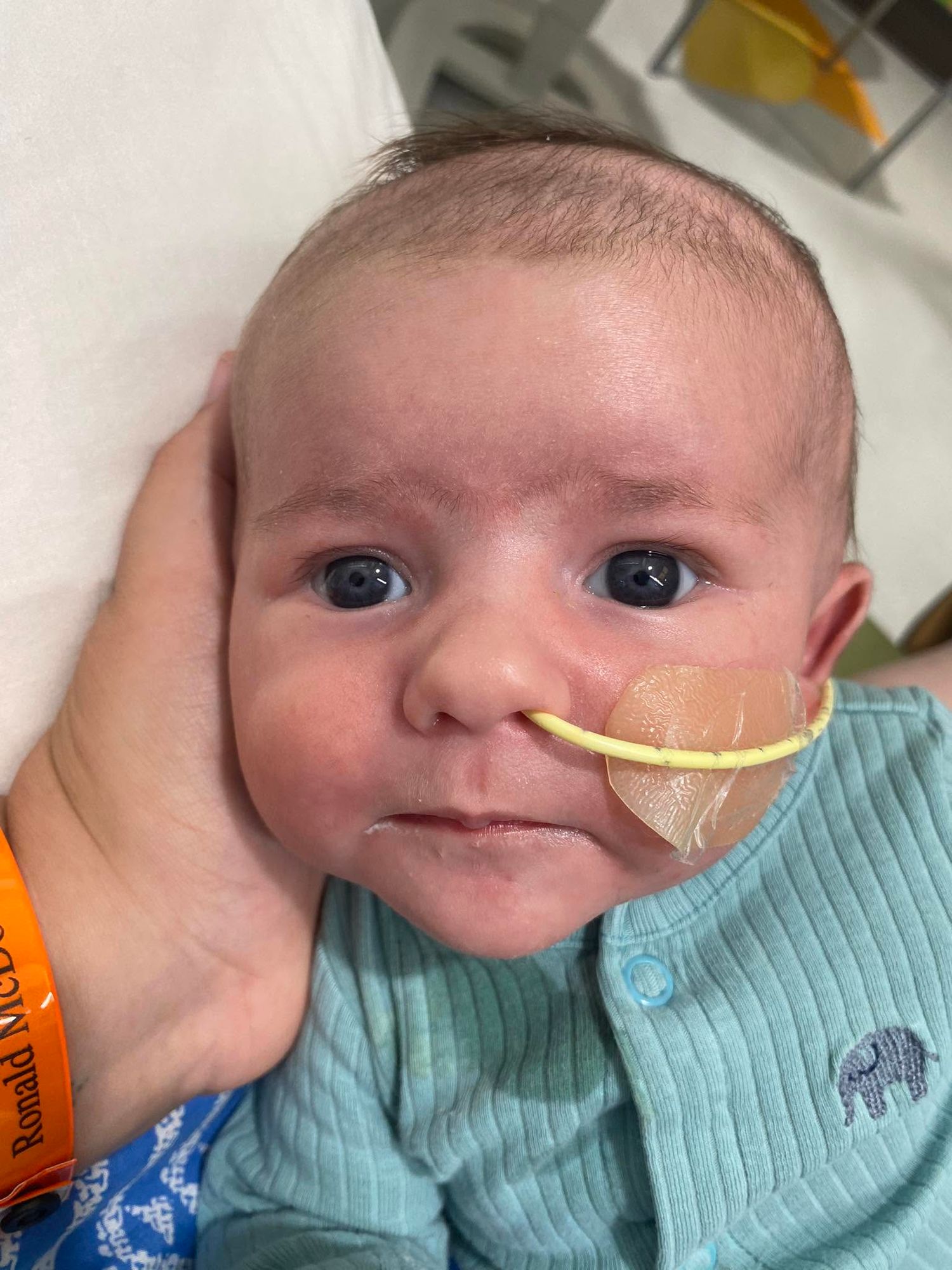 A newborn baby with a feeding tube taped to their nose wearing a teal onesie being held in a hospital setting.