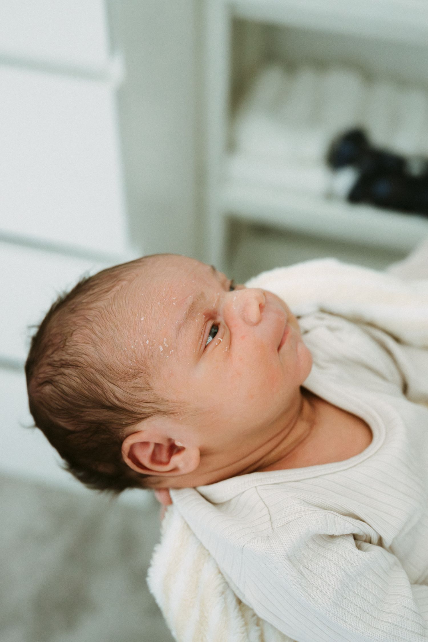 Close-up of newborn baby in white onesie looking up with flaky skin.