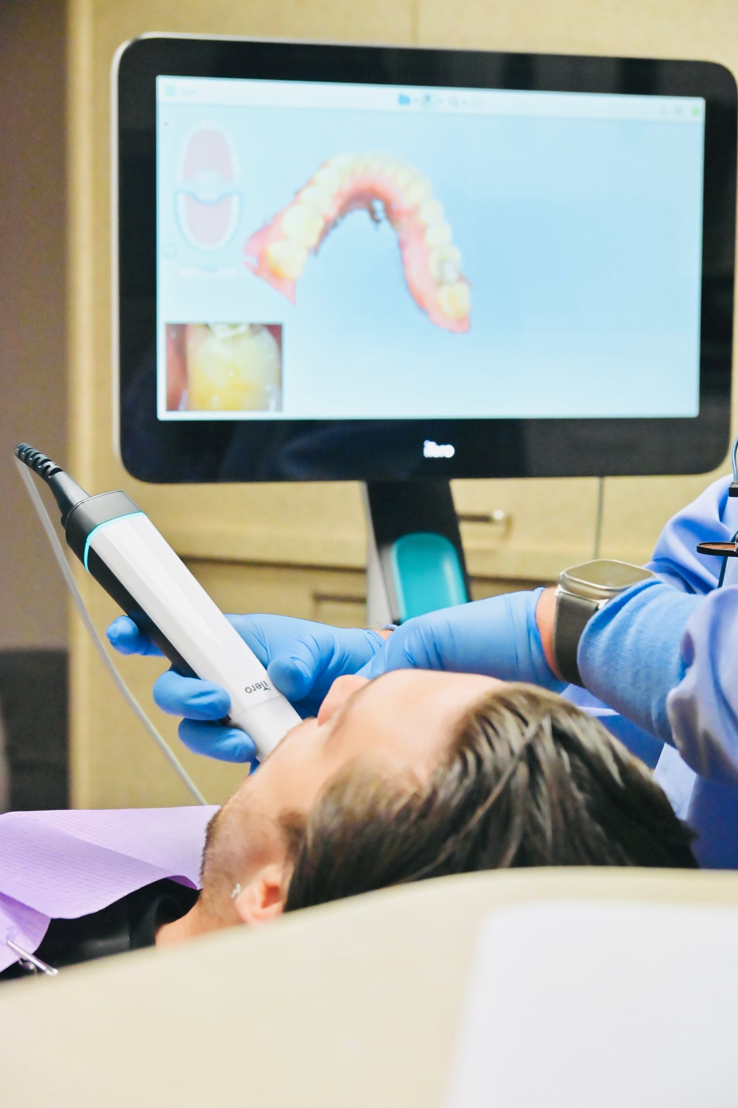 Dentist using a digital intraoral scanner on a patient with a 3D tooth model displayed on screen.
