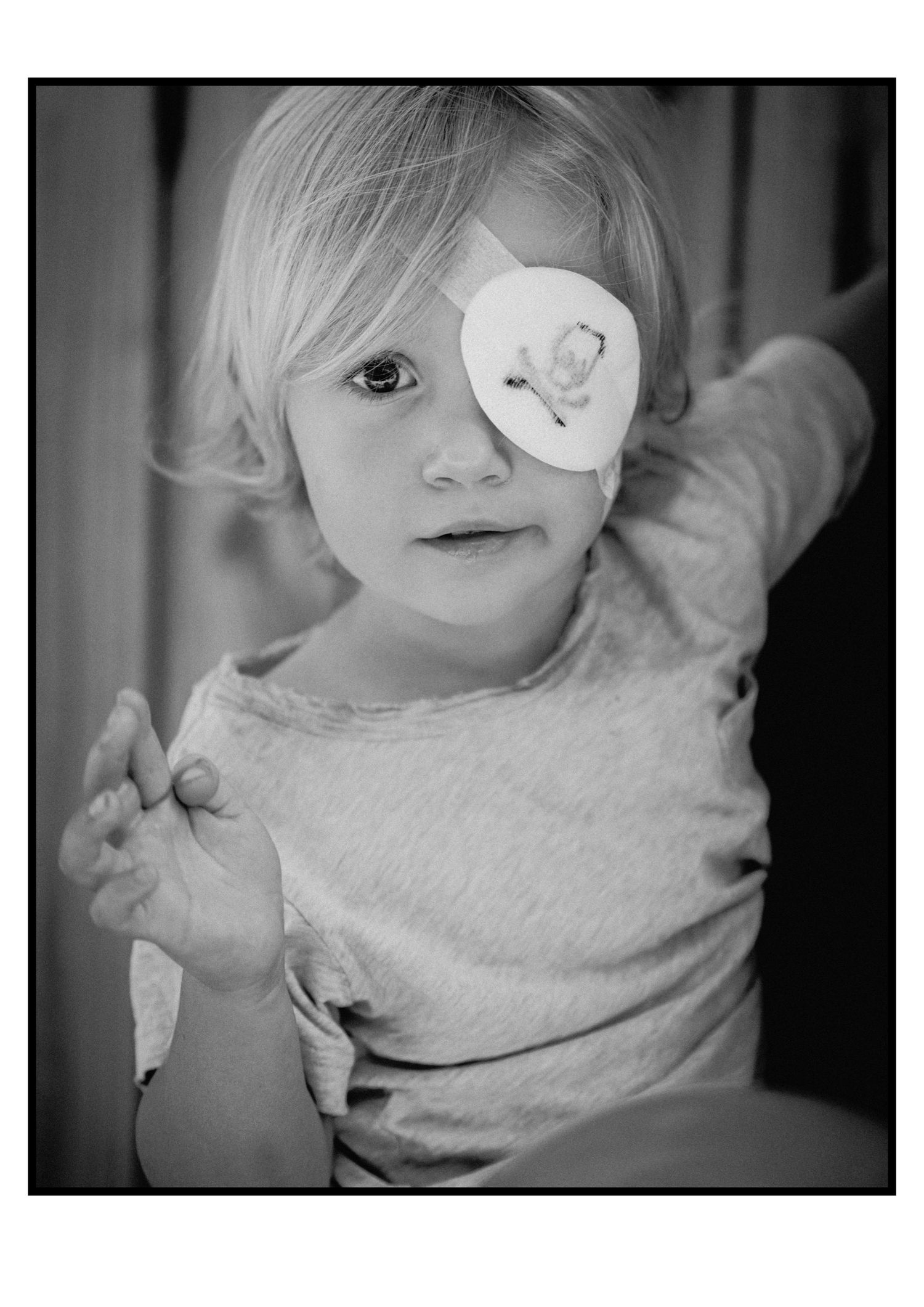Young blonde child with medical eye patch poses curiously in soft black and white portrait photograph.