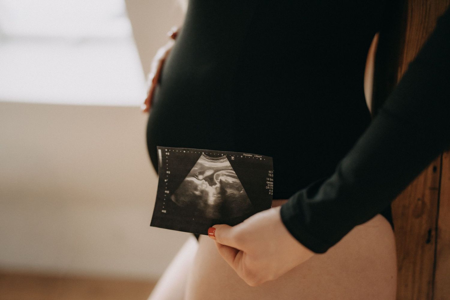 A black and white ultrasound image being held in someone's hands.