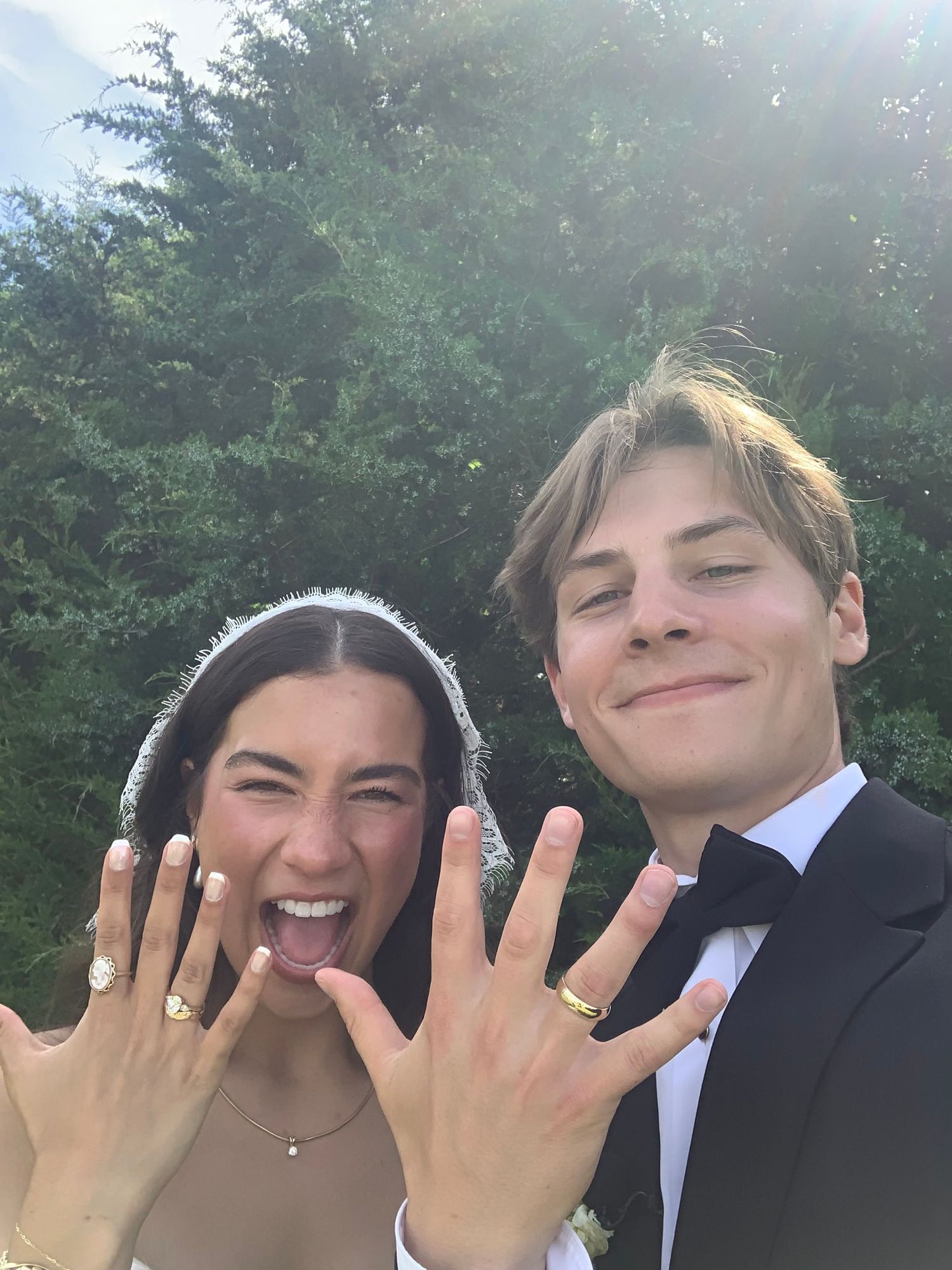 Newly engaged couple showing off their rings with excited expressions outdoors near evergreen trees.