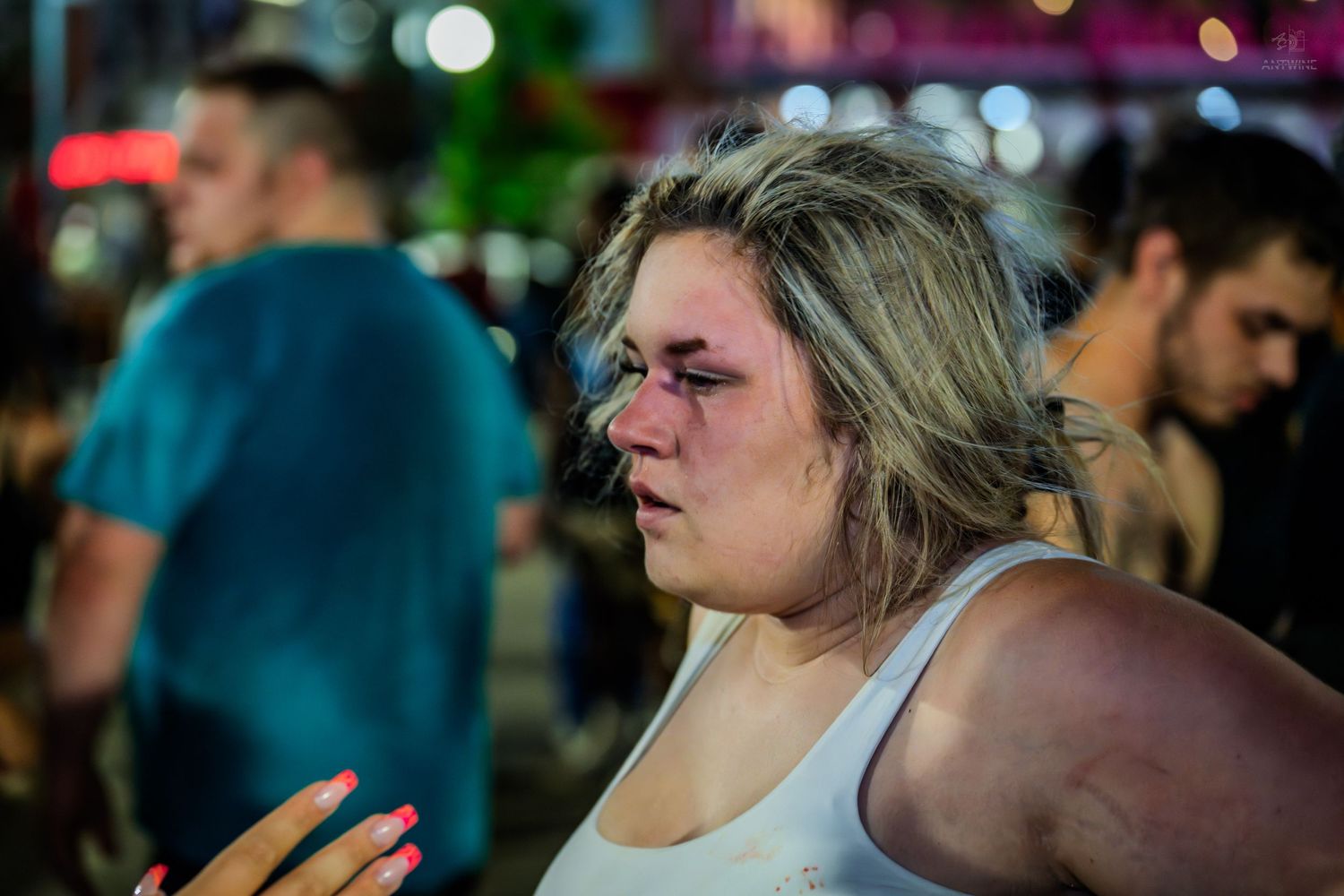 Young blonde woman with a bruised eye standing outdoors on a crowded night street.