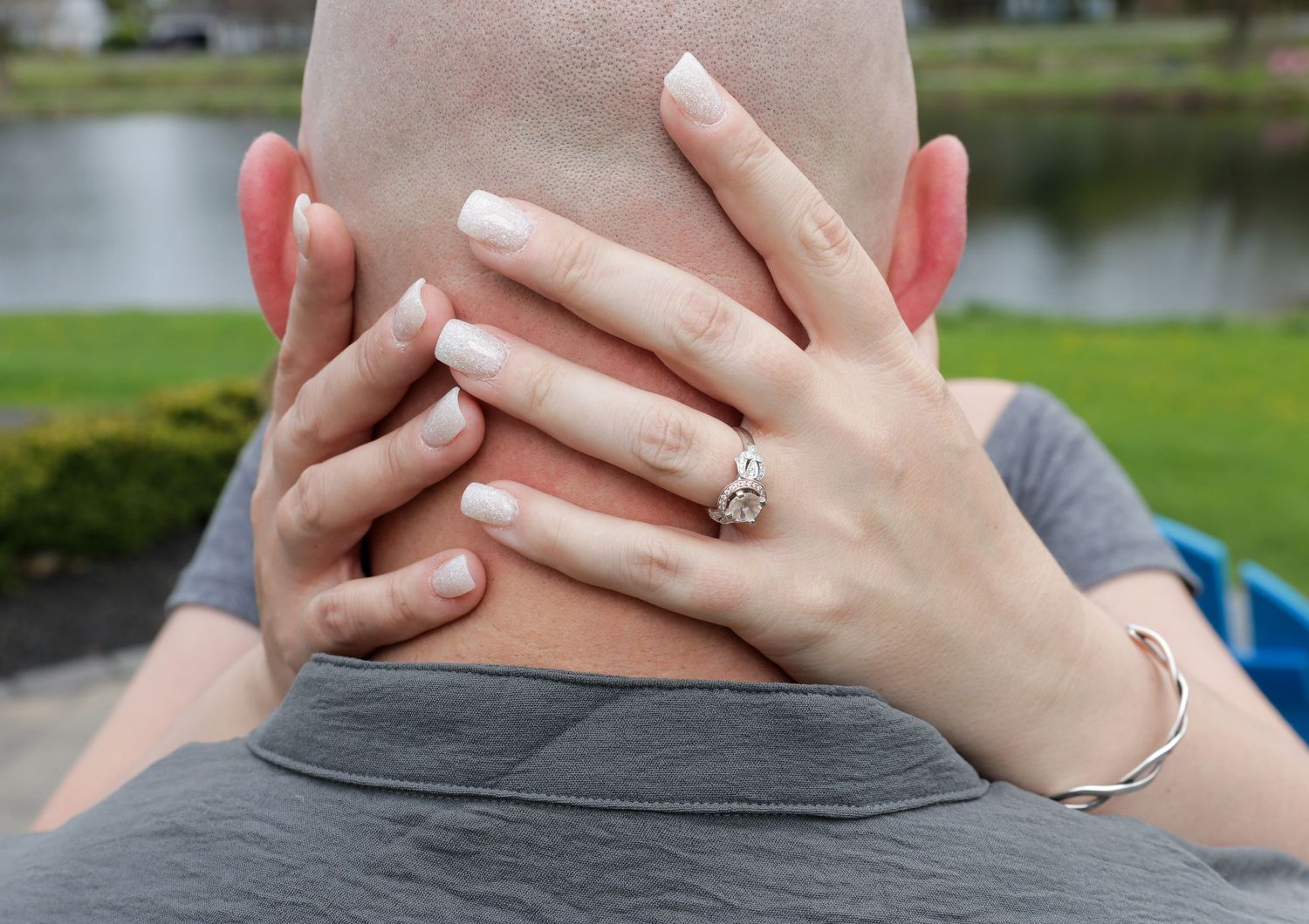Woman's hands with a sparkling diamond engagement ring wrapped around the back of a bald man's head beside a calm lake.