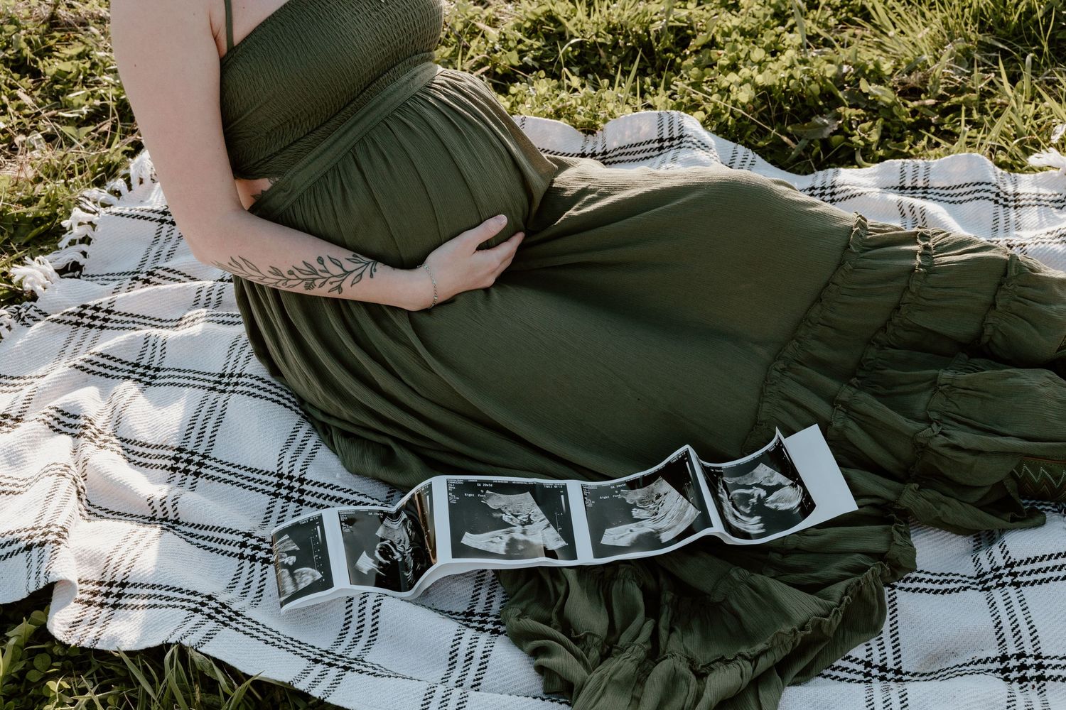 Ultrasound photos displayed on a plaid blanket beside a person wearing a dark green maternity dress.