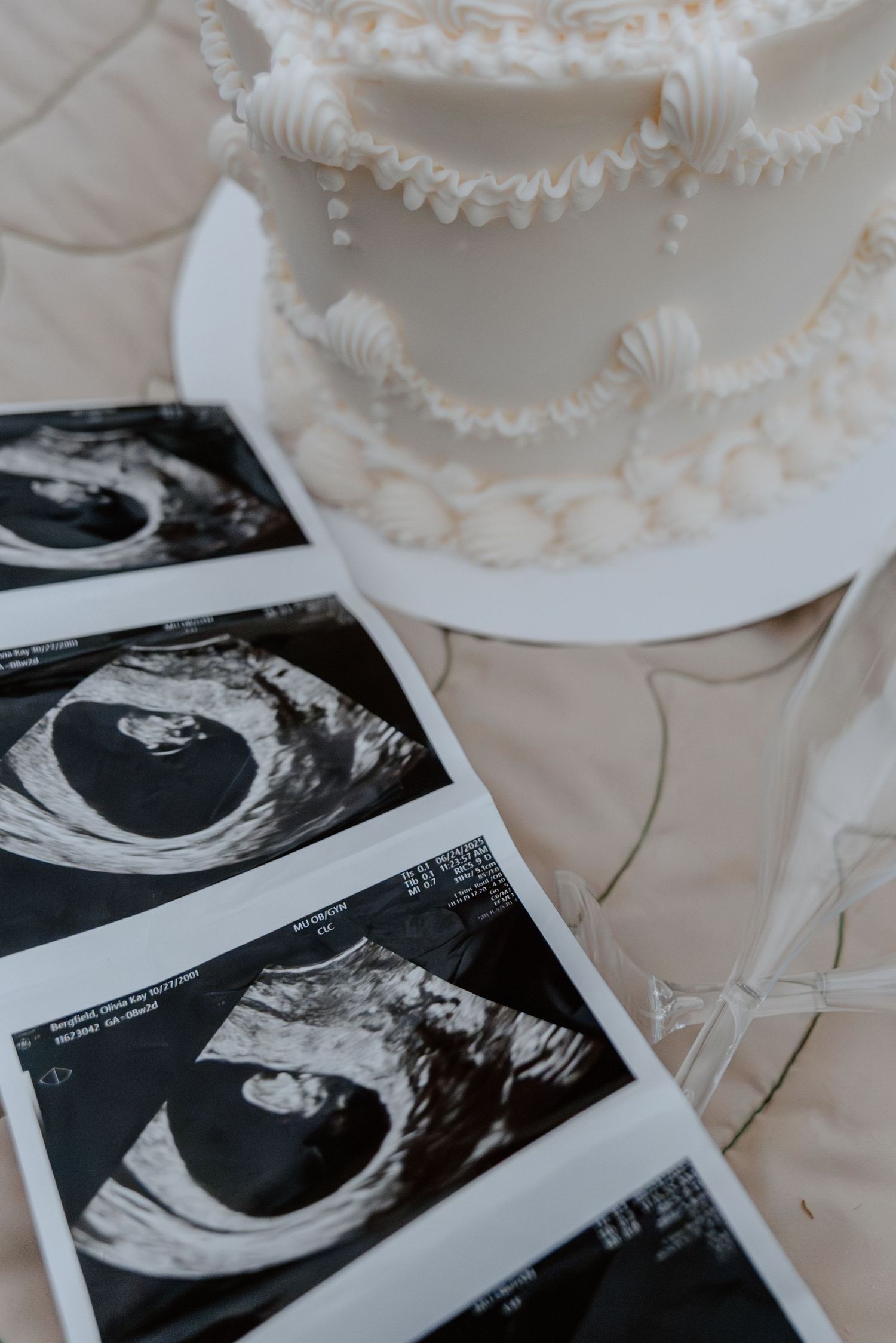 A row of ultrasound sonogram photos displayed in front of an elegant white wedding cake with shell decorations.