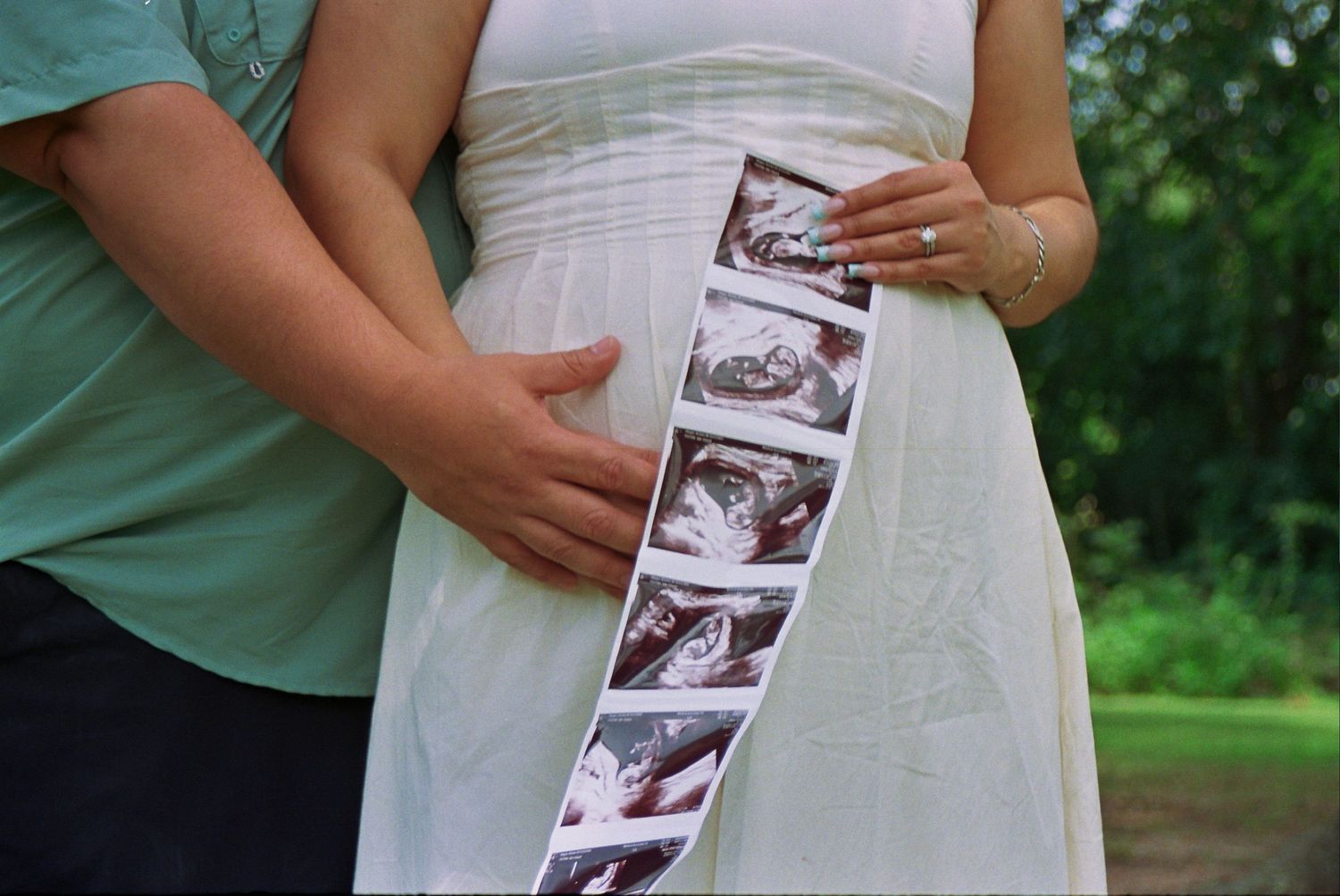 Pregnant couple holding ultrasound strip photos while man embraces woman's baby bump outdoors.