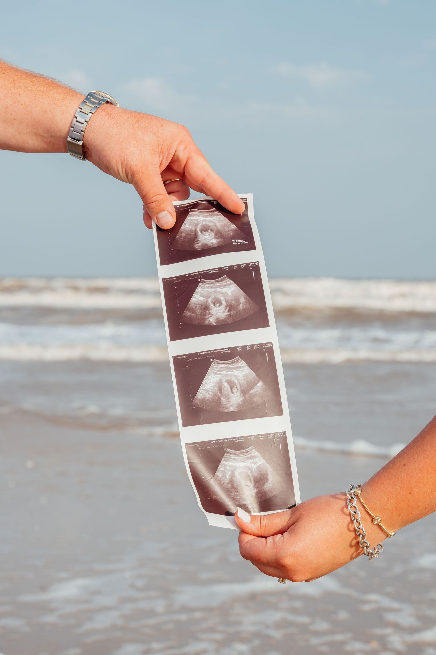 Ultrasound photos being held up against an ocean beach background.