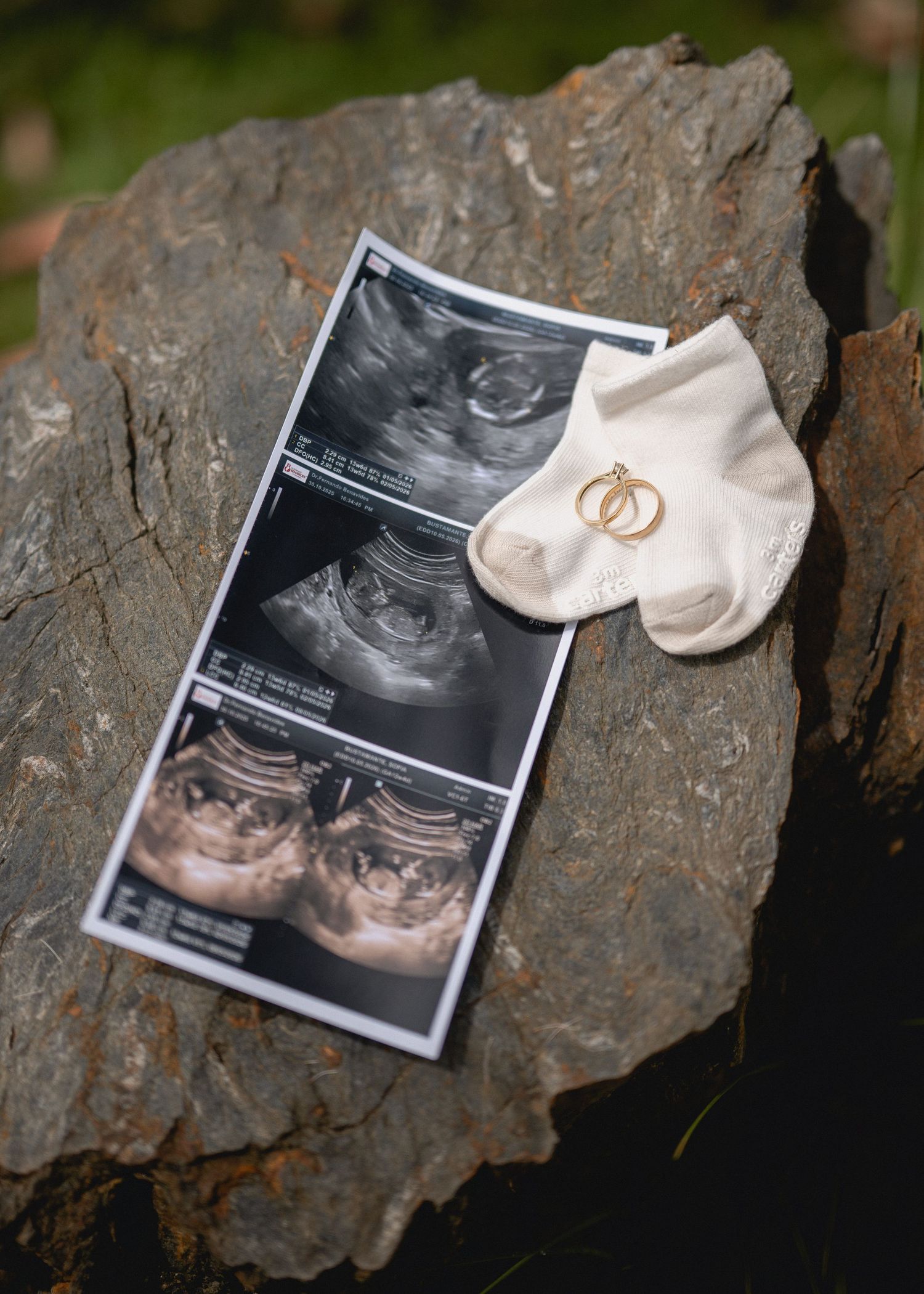 Ultrasound photos and tiny baby shoes displayed on a rustic stone surface outdoors.