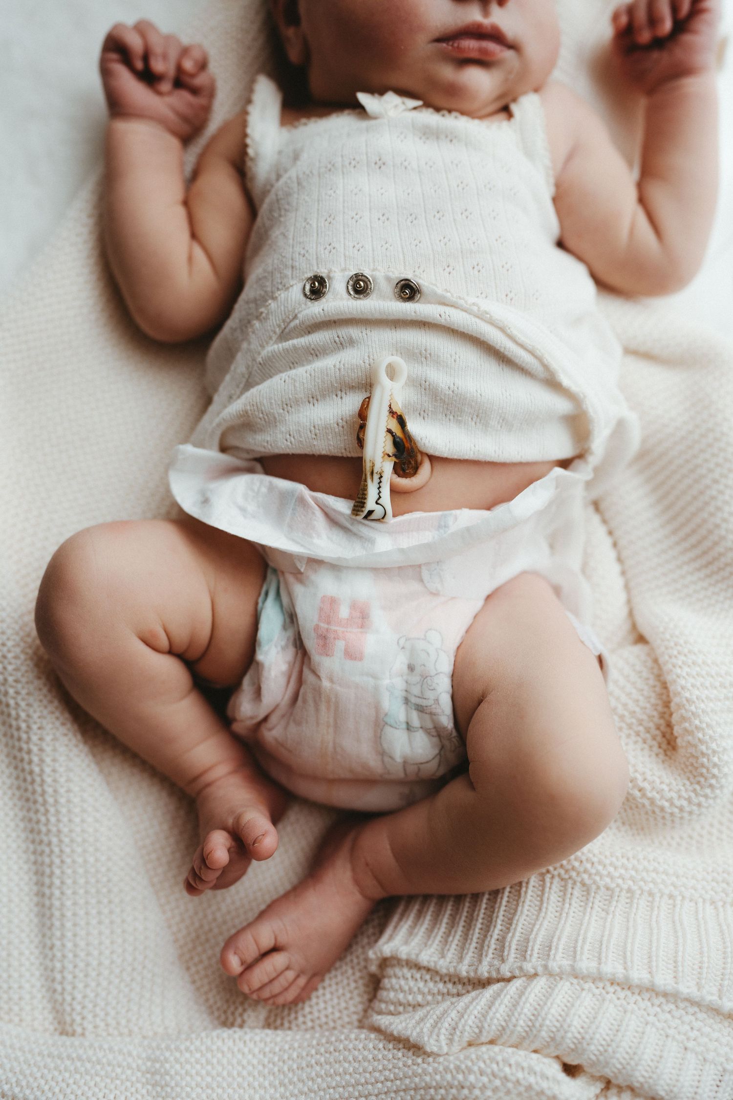 Newborn baby lying on white blanket with romper pulled up revealing diaper and tiny feet.