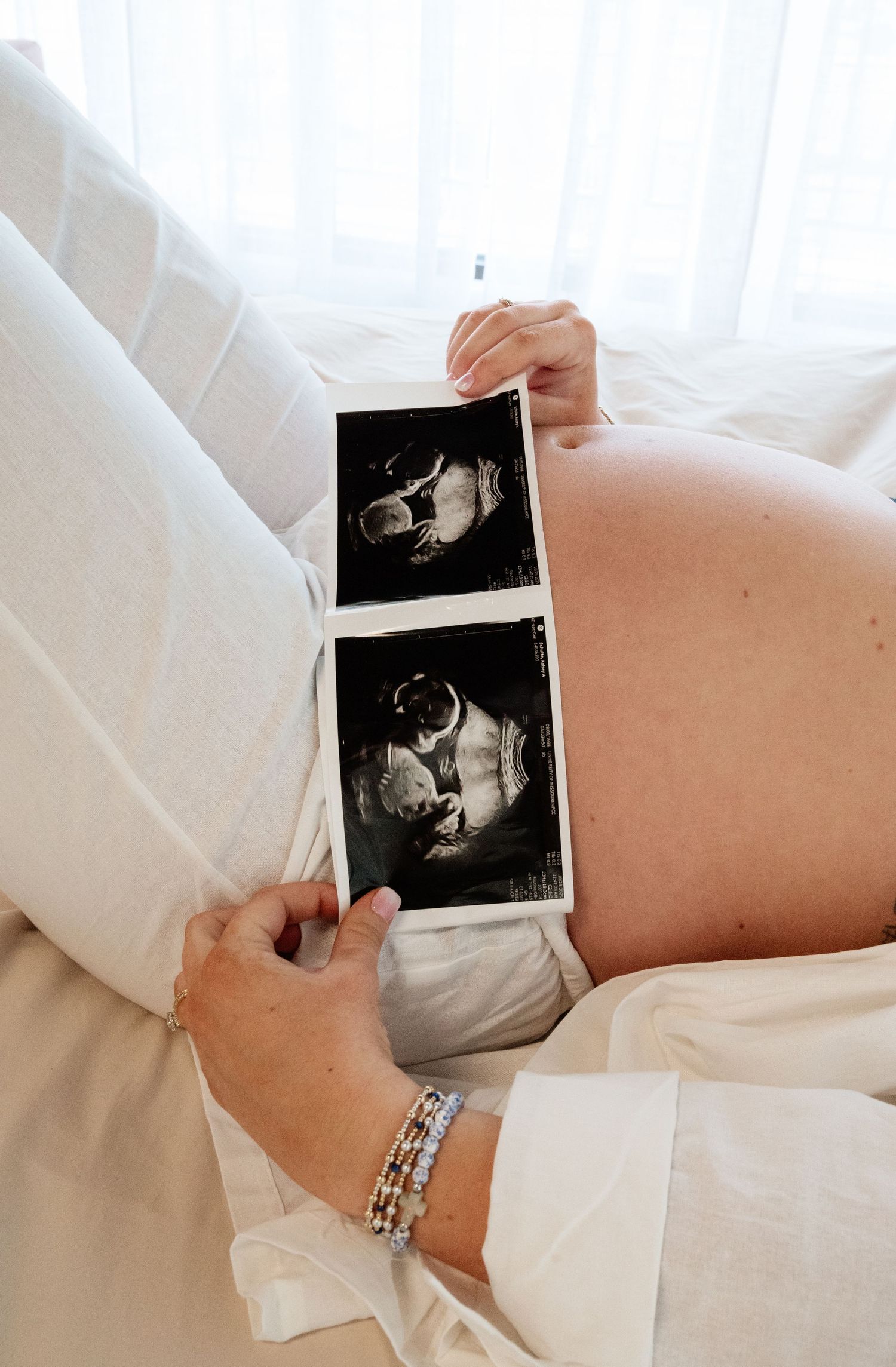 Close-up series of ultrasound photos being held against pregnant belly in white dress.