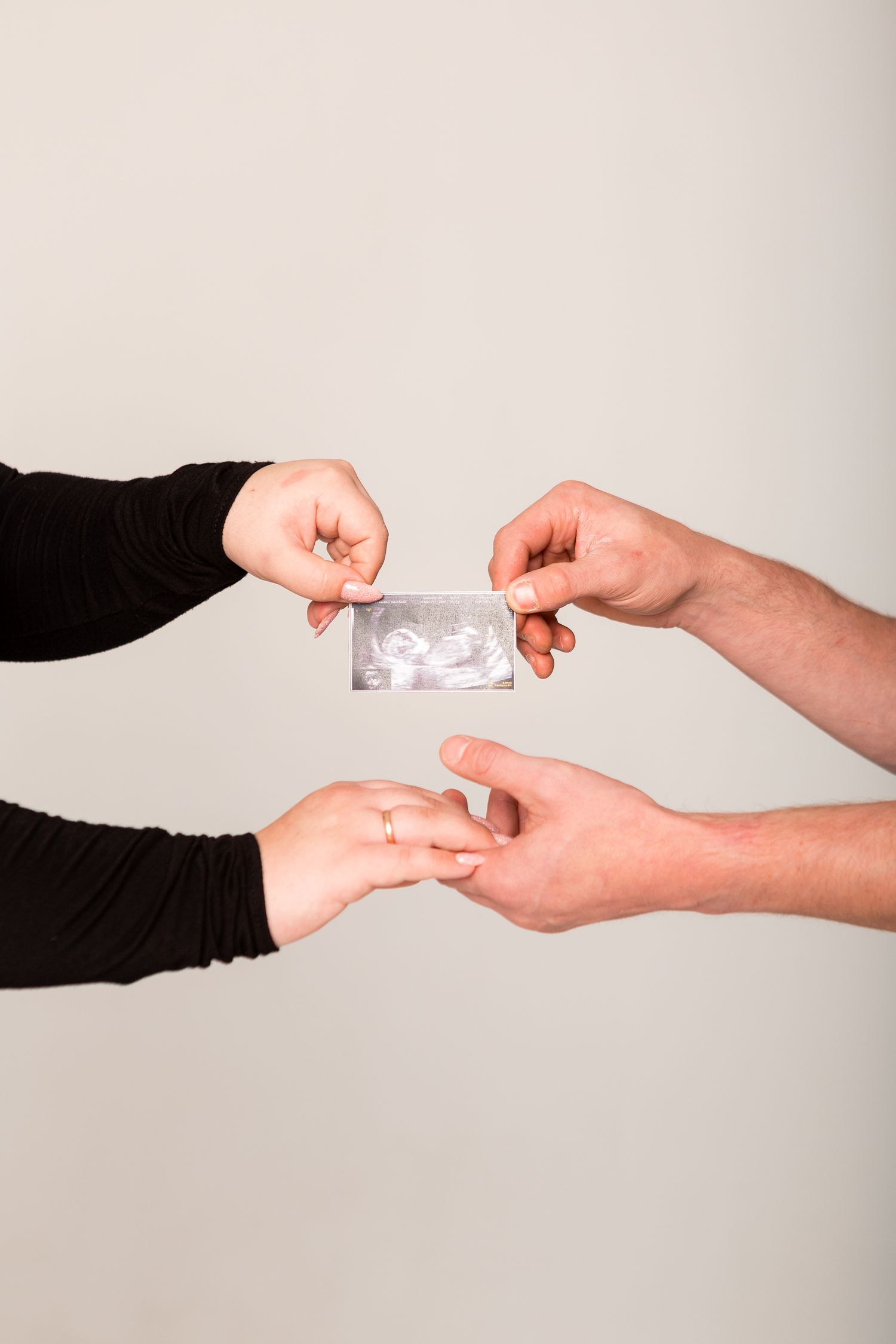 Hands exchanging ultrasound photo on white background.