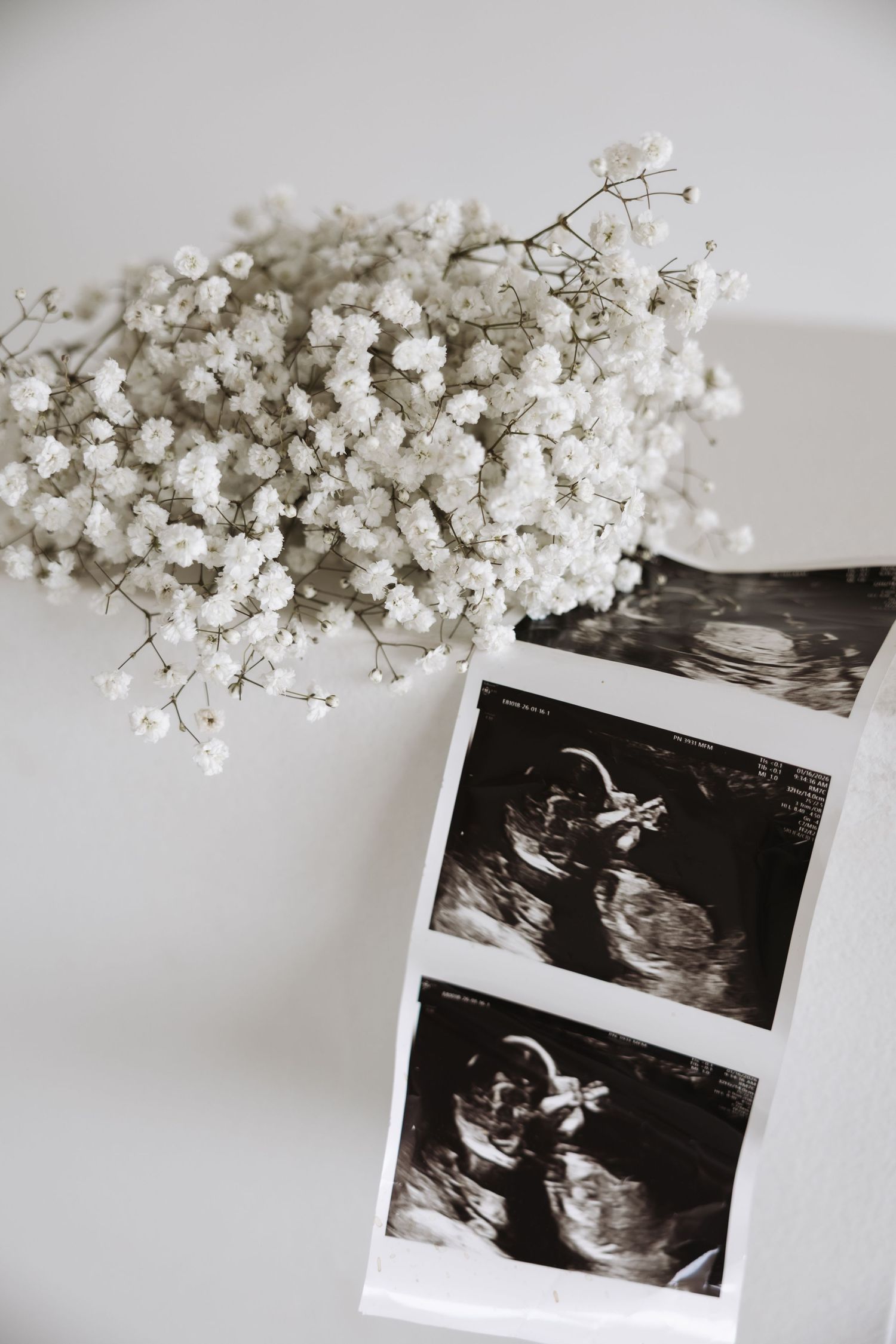 Baby ultrasound photos displayed beside delicate white gypsophila flowers on a light background.