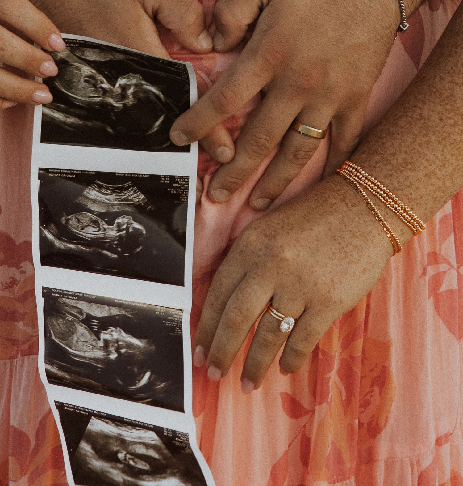 Hands holding ultrasound photos against pink floral dress fabric with wedding rings visible.