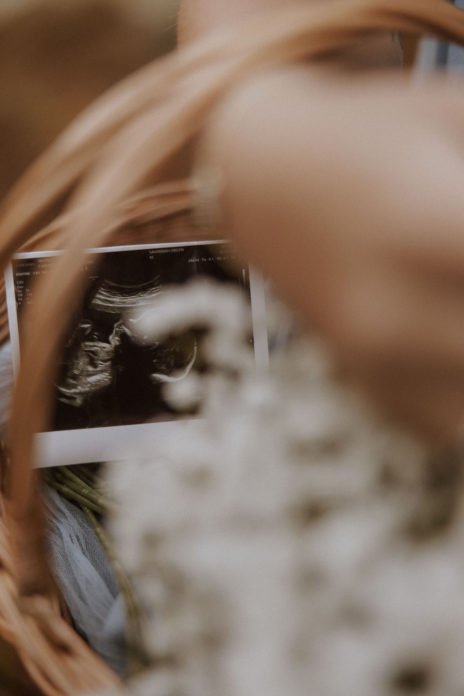 Artistic closeup of ultrasound photo with baby's breath flowers in woven basket.