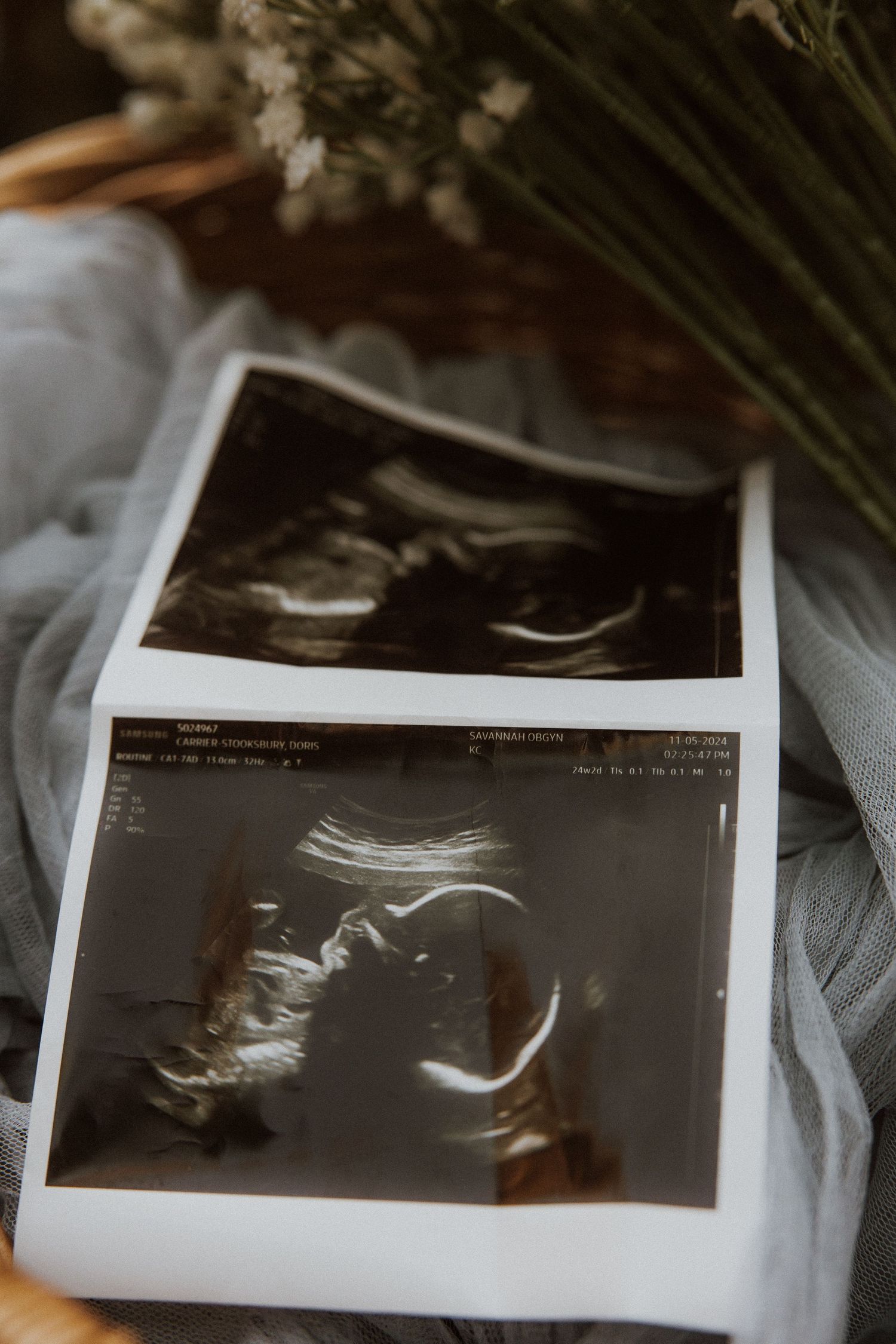 Ultrasound scan photo displayed with delicate baby's breath flowers on soft fabric.