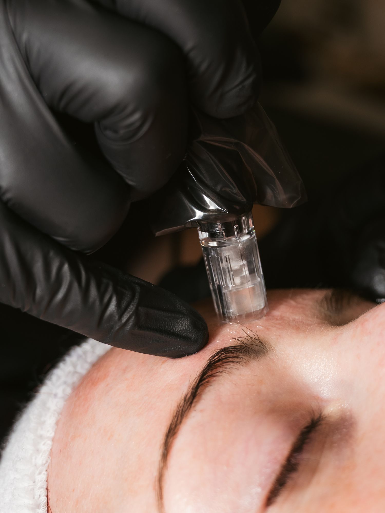 Branding Details Microneedling Facials