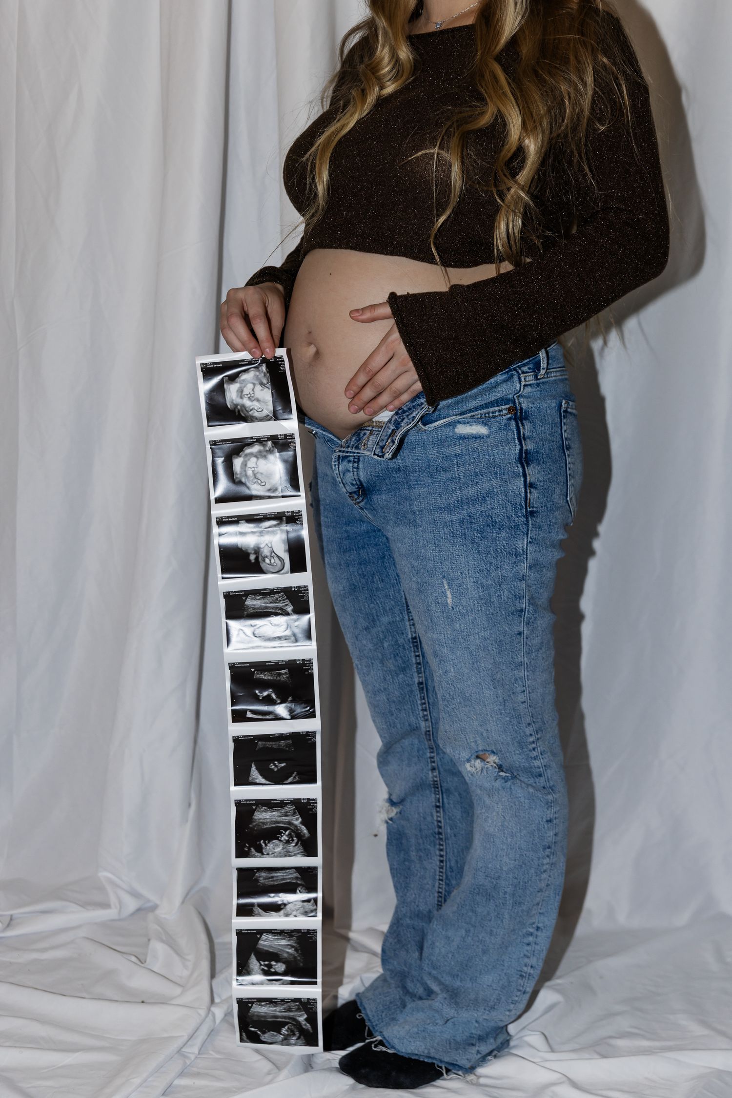 A series of pregnancy progress photos with ultrasound images displayed against a white background.