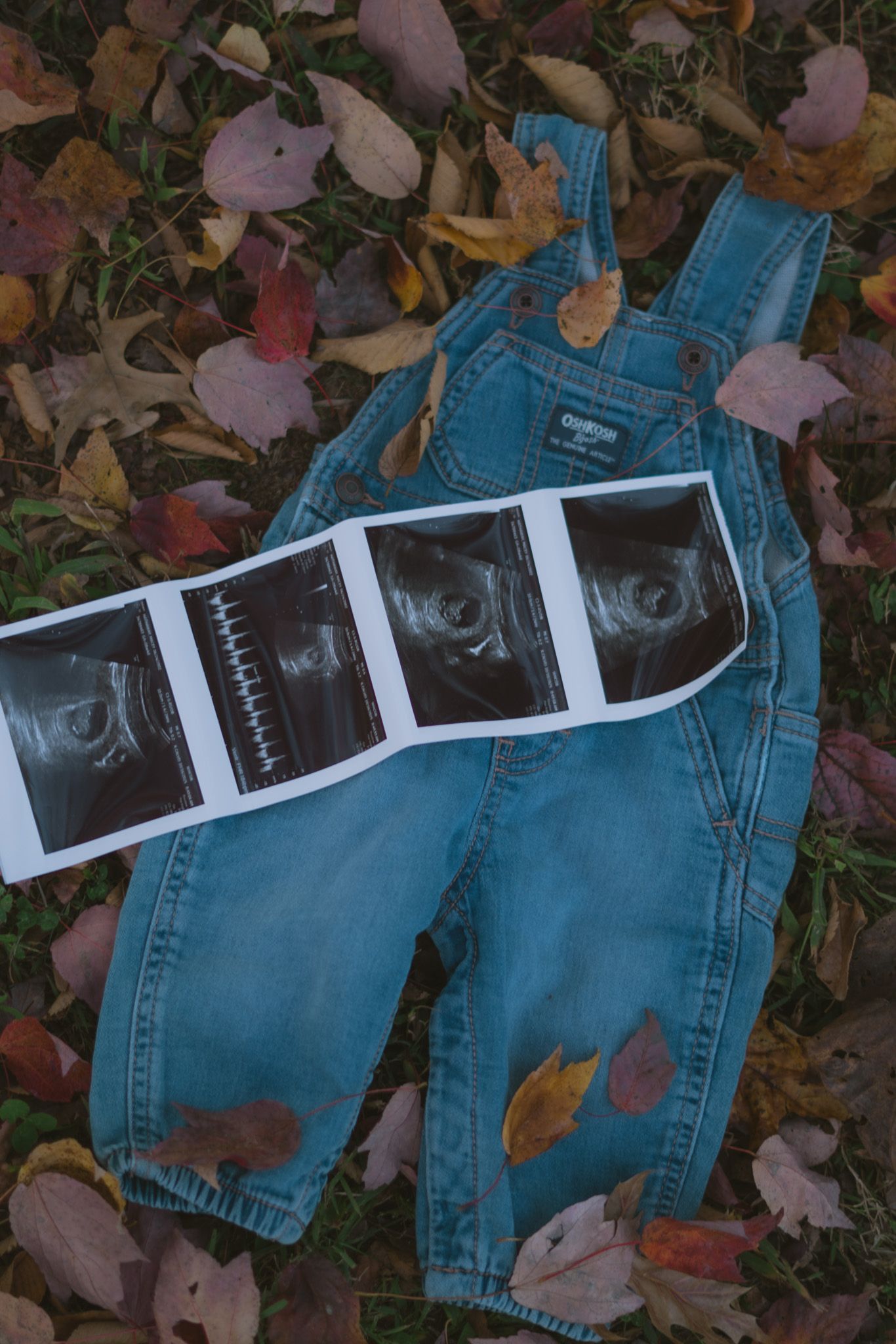 maternity photos