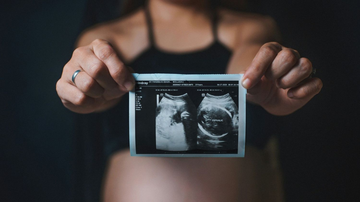 Pregnant woman in sports bra holding an ultrasound scan photo in front of her bare bump.