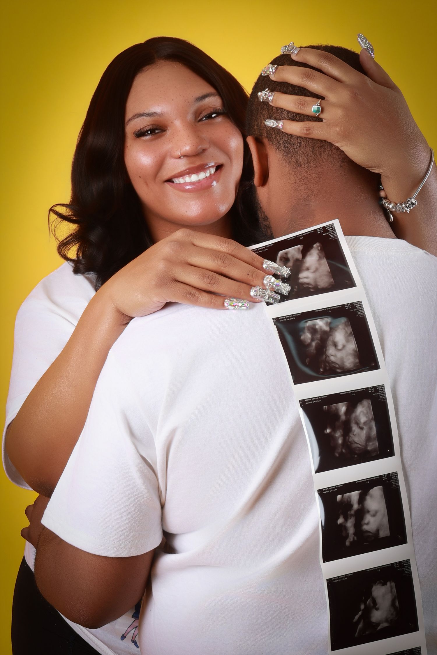 Smiling pregnant woman hugging partner while holding ultrasound photos on yellow background.