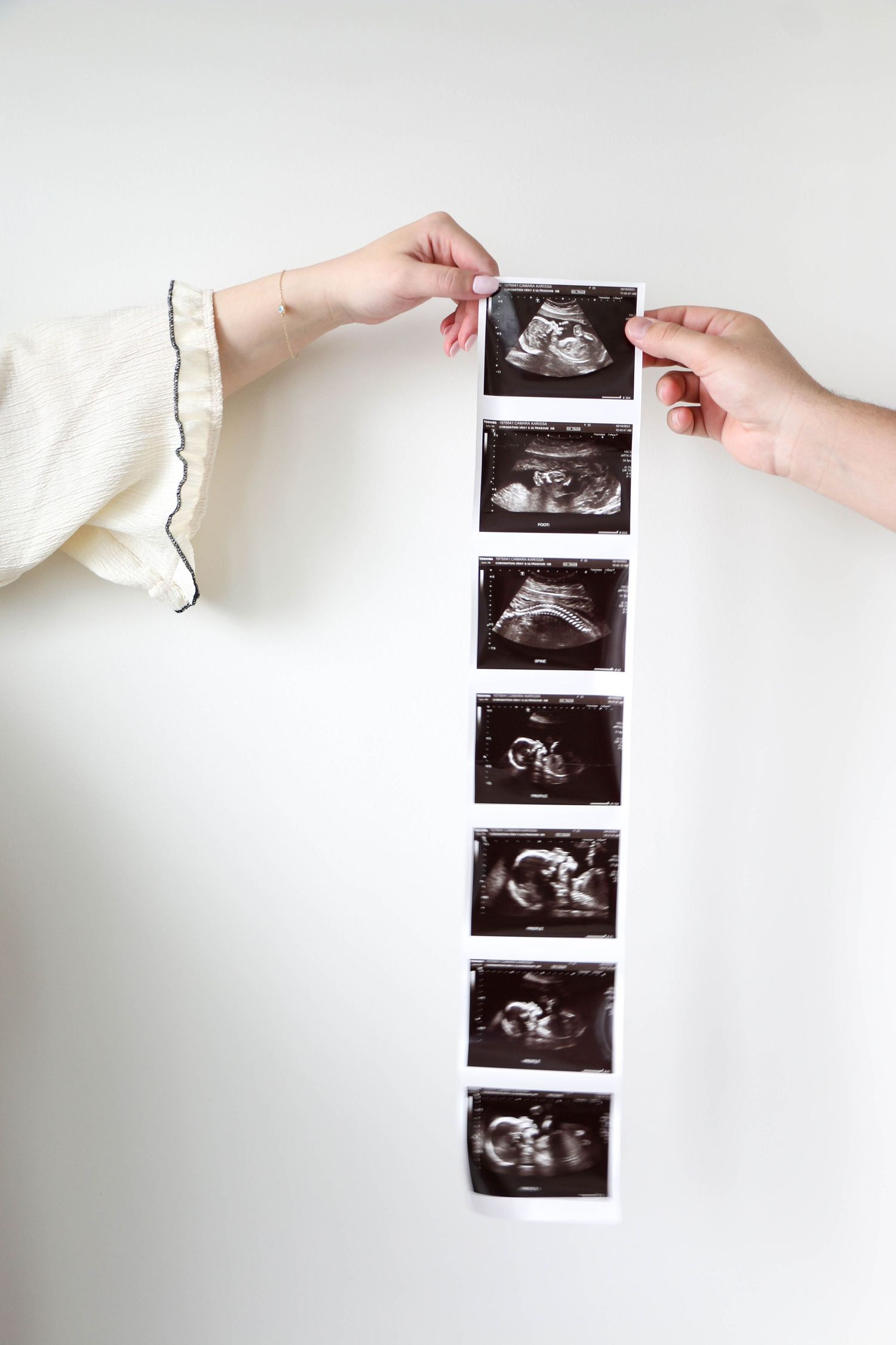 Hands arranging a series of ultrasound sonogram photos showing fetal development against a white background.