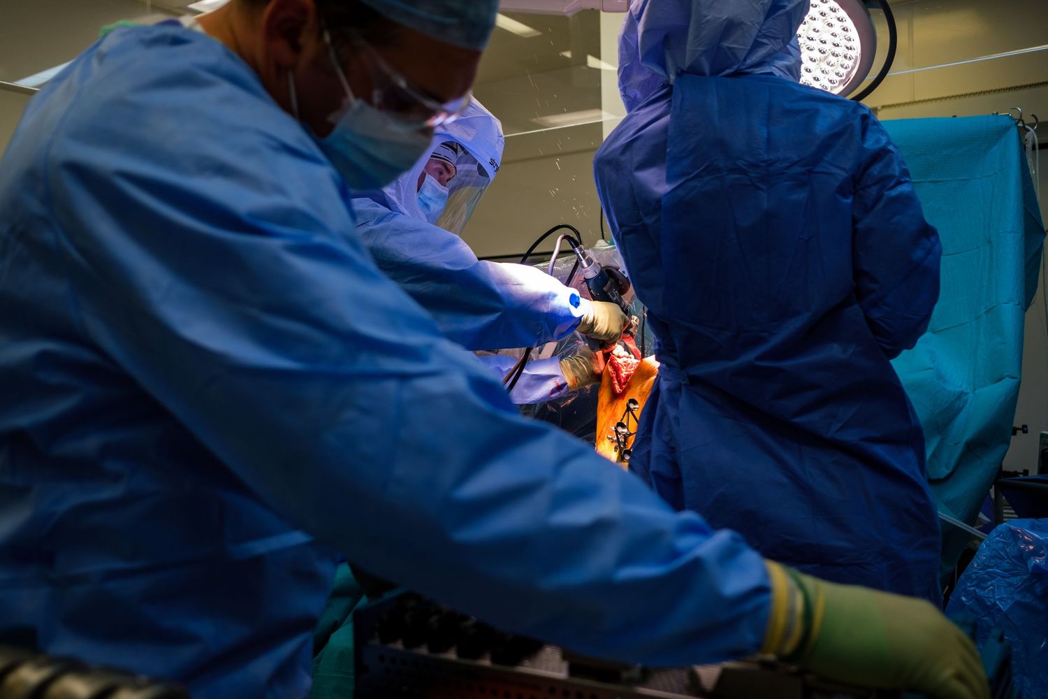 Medical professionals performing surgery in operating room with blue surgical gear.