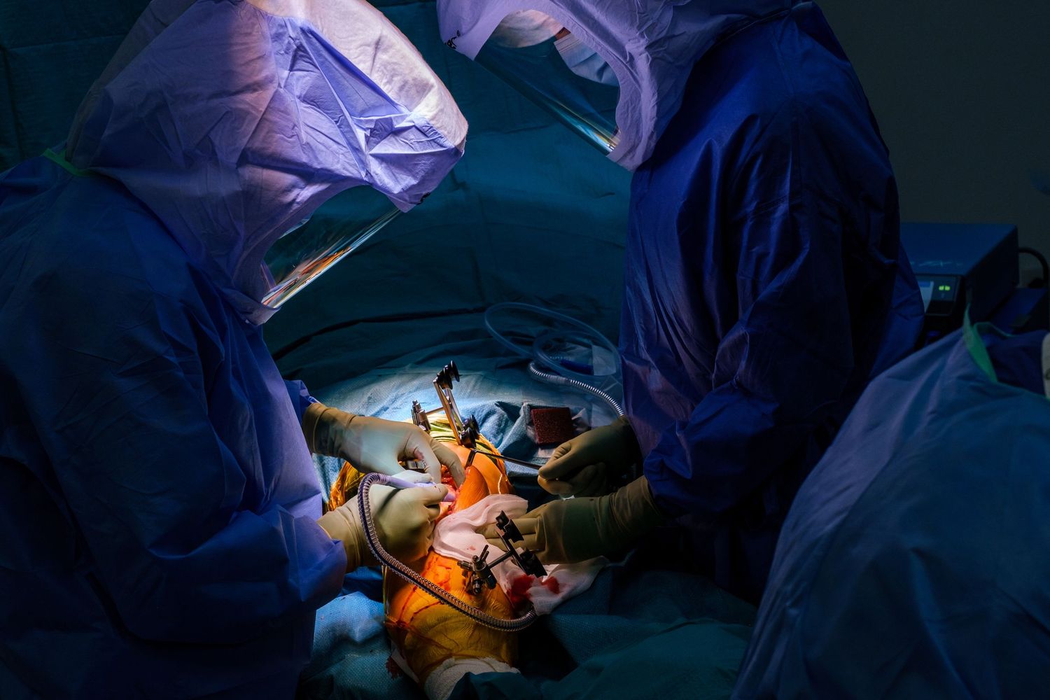 A time-lapse sequence showing stages of laparoscopic surgery in an operating room under blue surgical lighting.
