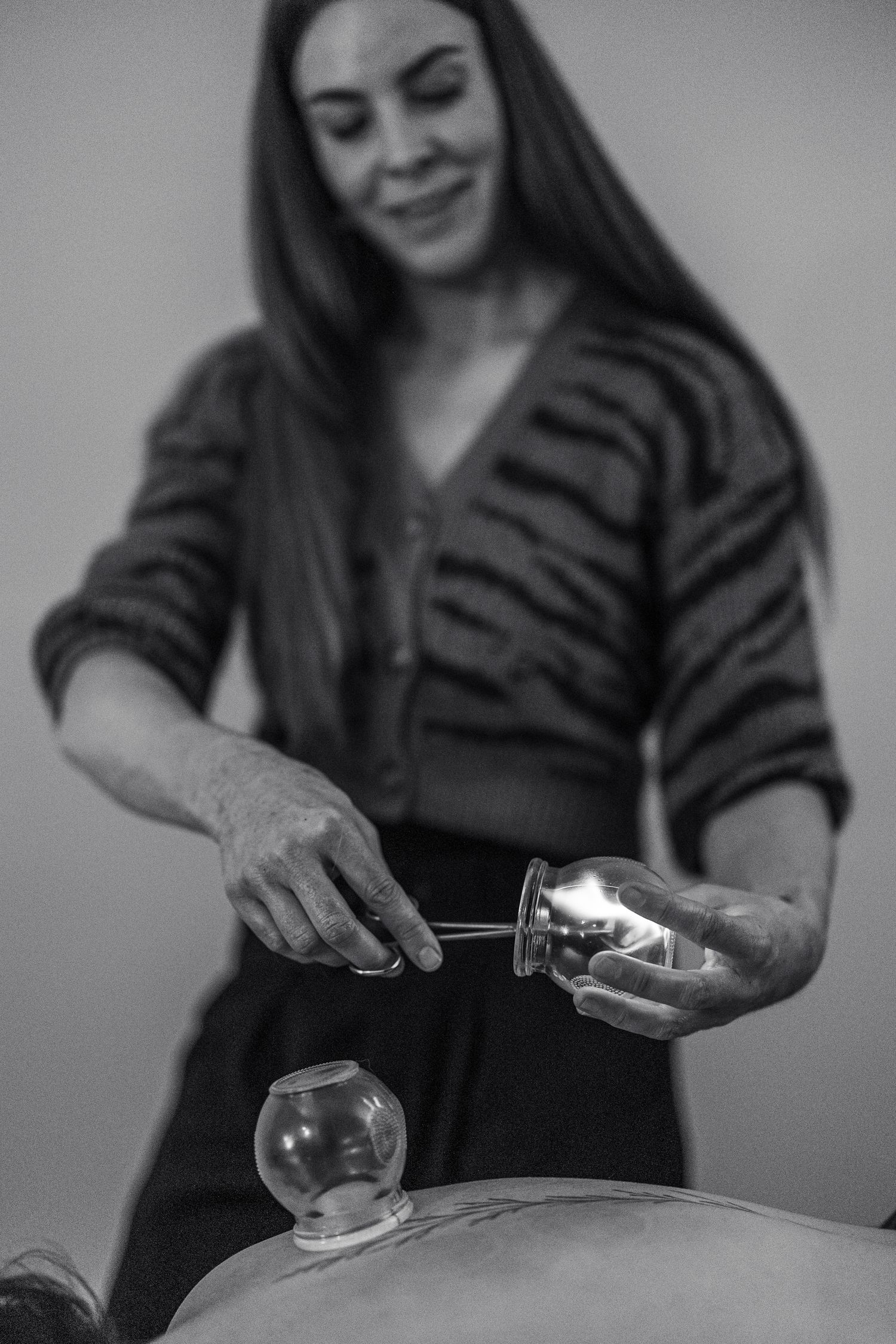 Black and white photo of a smiling therapist performing cupping therapy on a patient's back.
