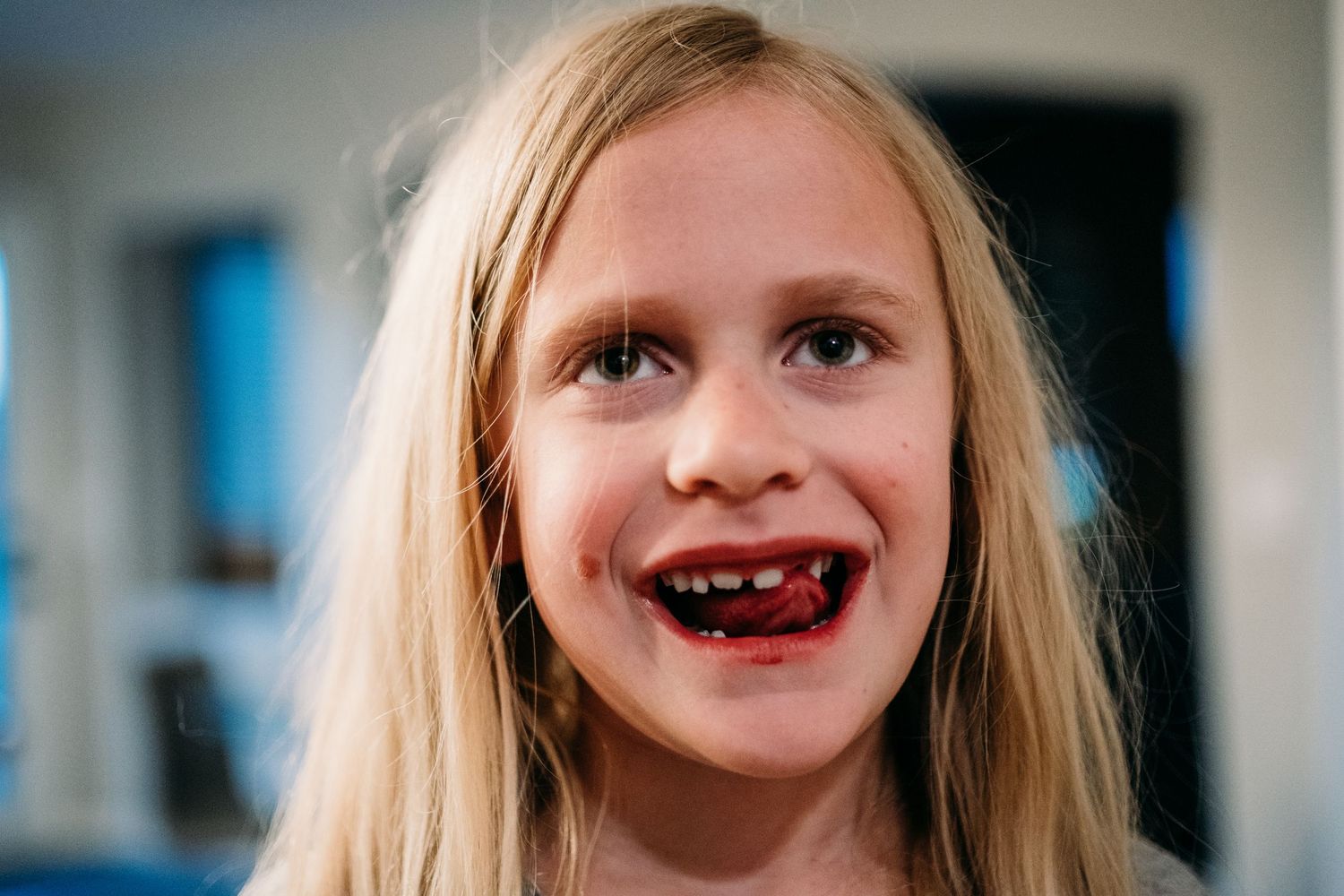 Young girl who has recently lost a tooth, smiling.