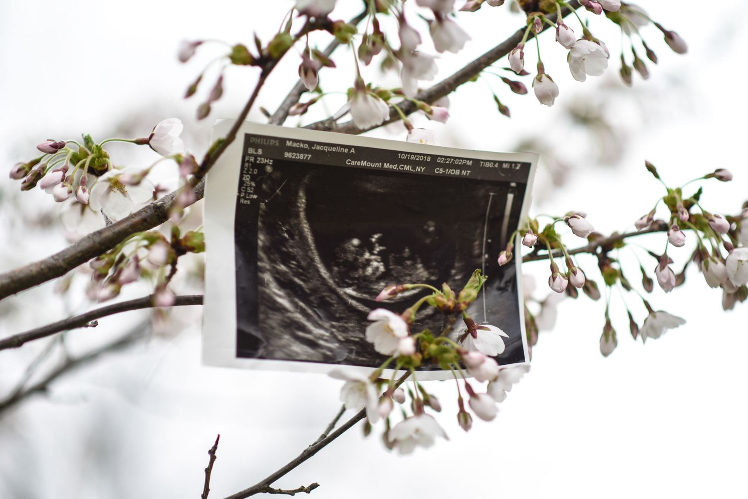 Cherry blossom branches with delicate white petals bloom against a soft blurred background in springtime.