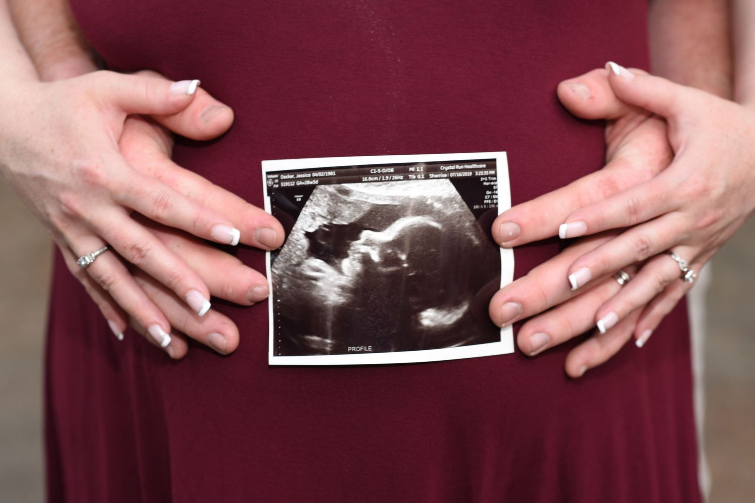 Hands holding ultrasound photo against burgundy maternity dress showing baby scan image.